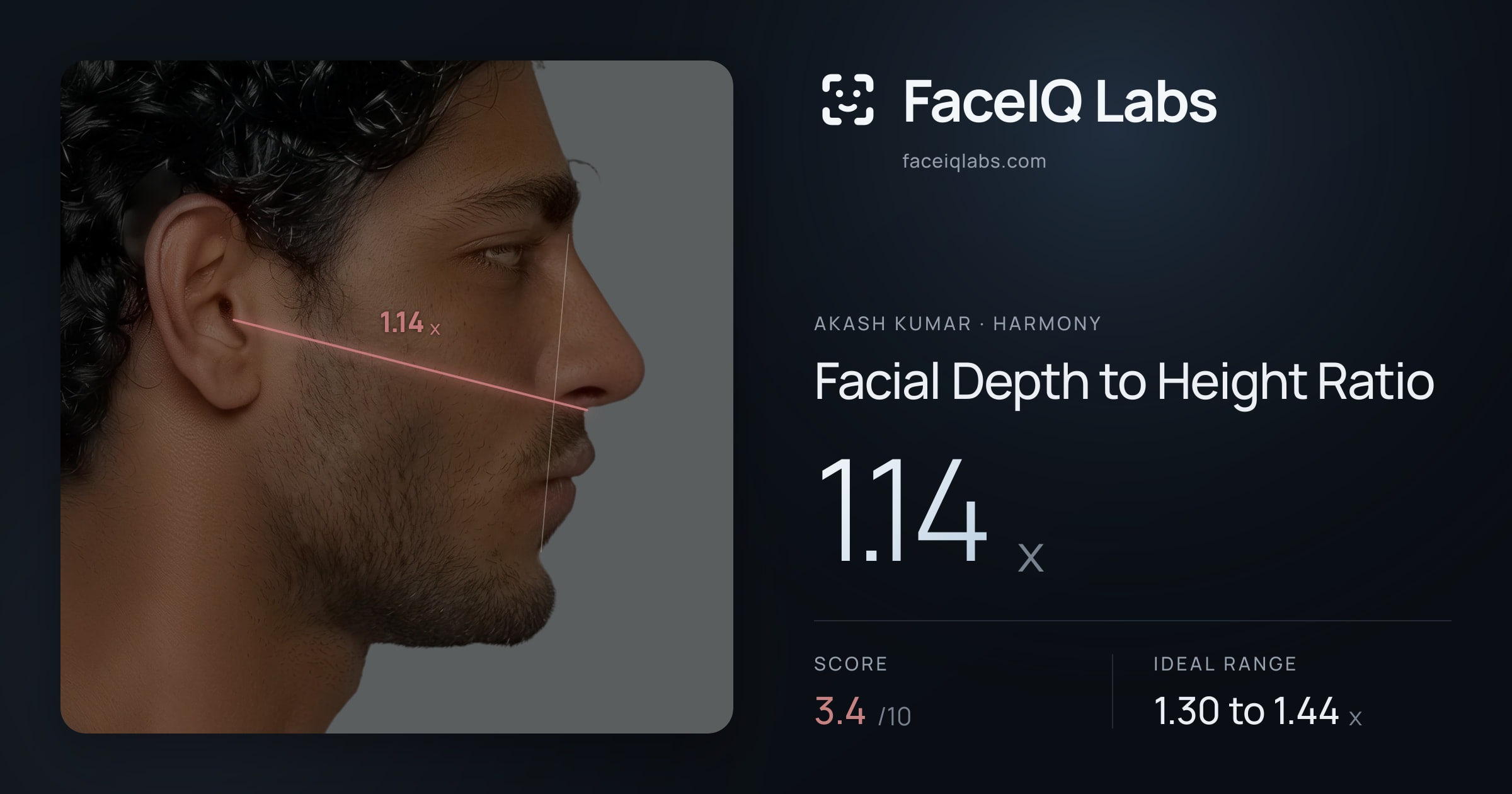 Akash Kumar Facial Depth to Height Ratio: 1.14x, drawn on the photo