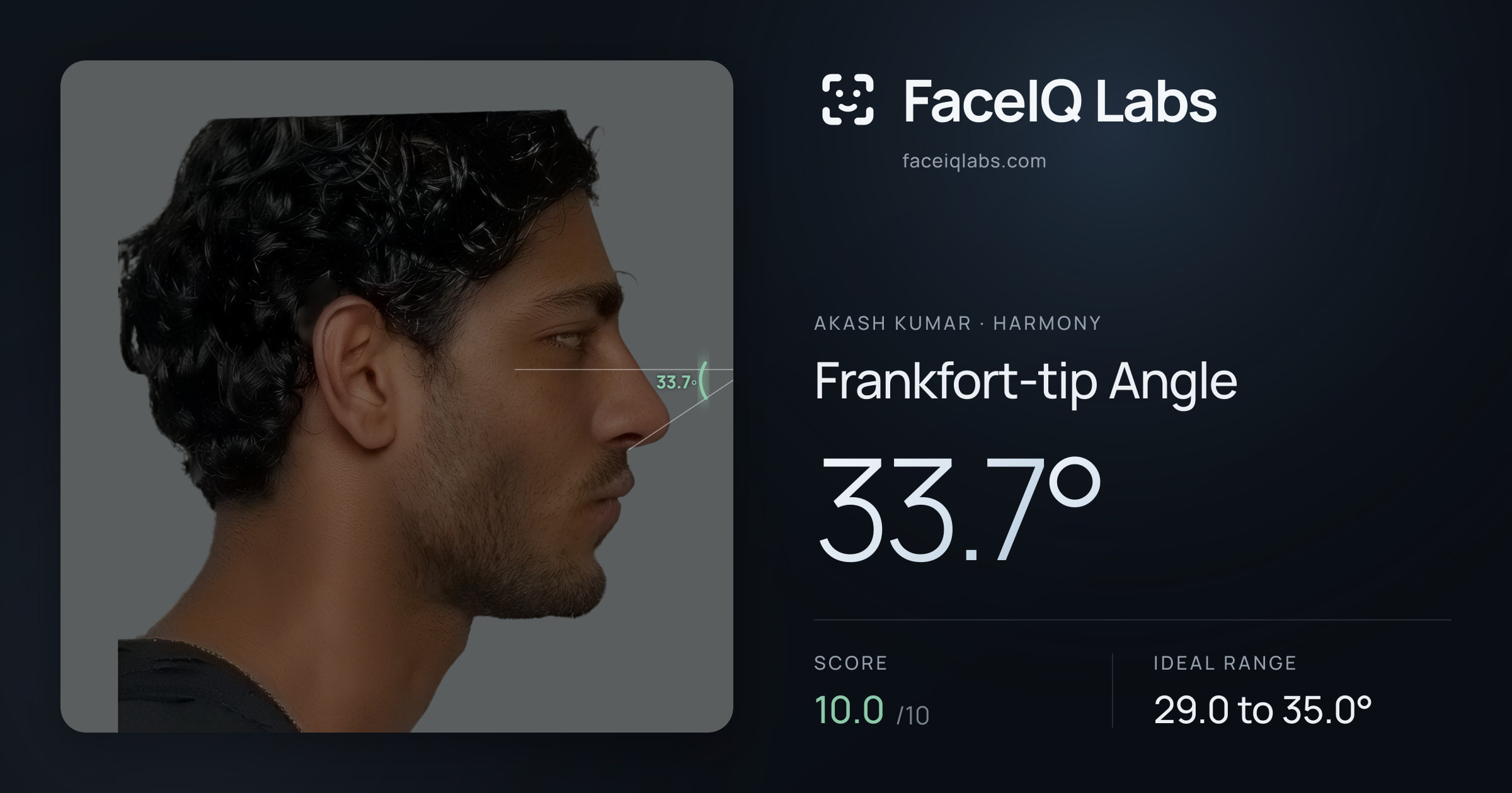 Akash Kumar Frankfort-tip Angle: 33.7°, drawn on the photo