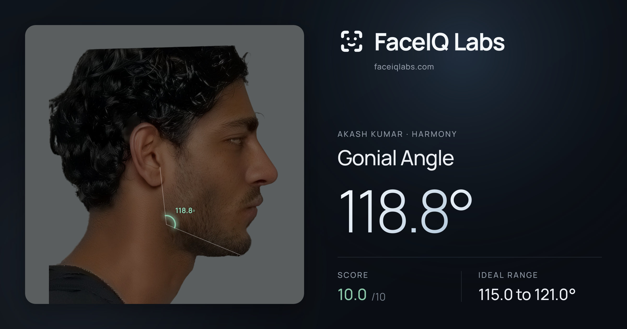 Akash Kumar Gonial Angle: 118.8°, drawn on the photo