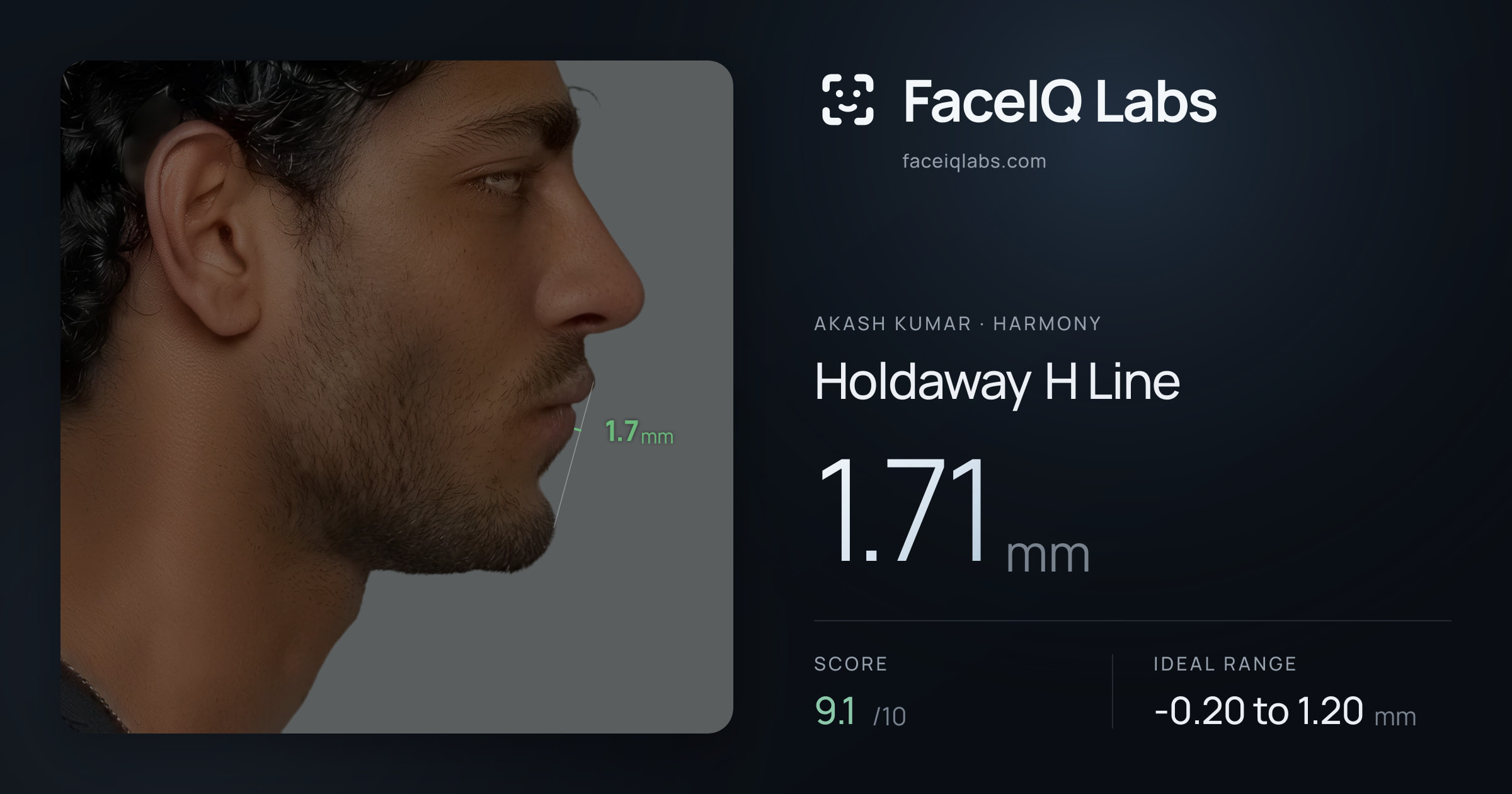 Akash Kumar Holdaway H Line: 1.71mm, drawn on the photo