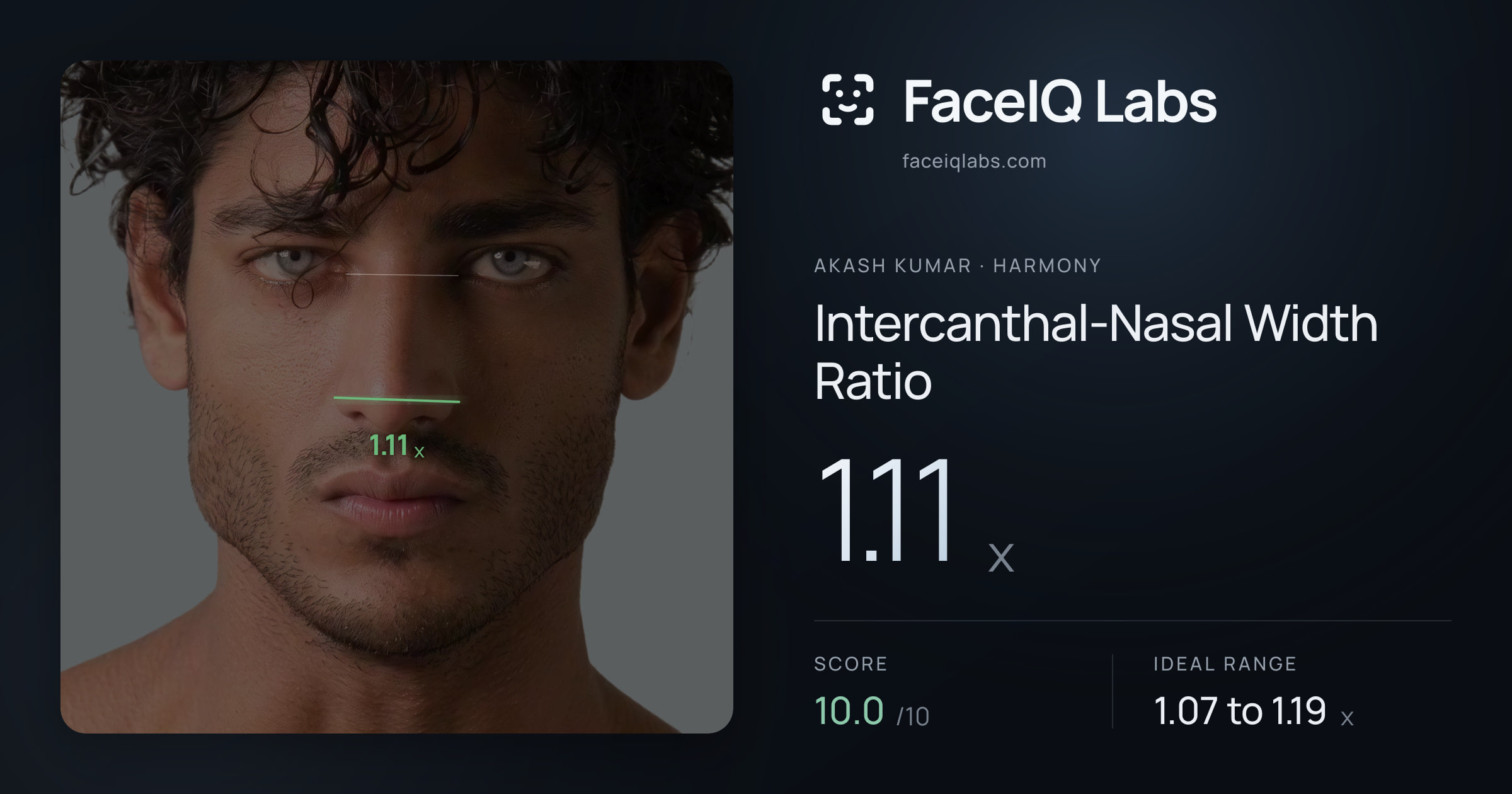 Akash Kumar Intercanthal-Nasal Width Ratio: 1.11x, drawn on the photo