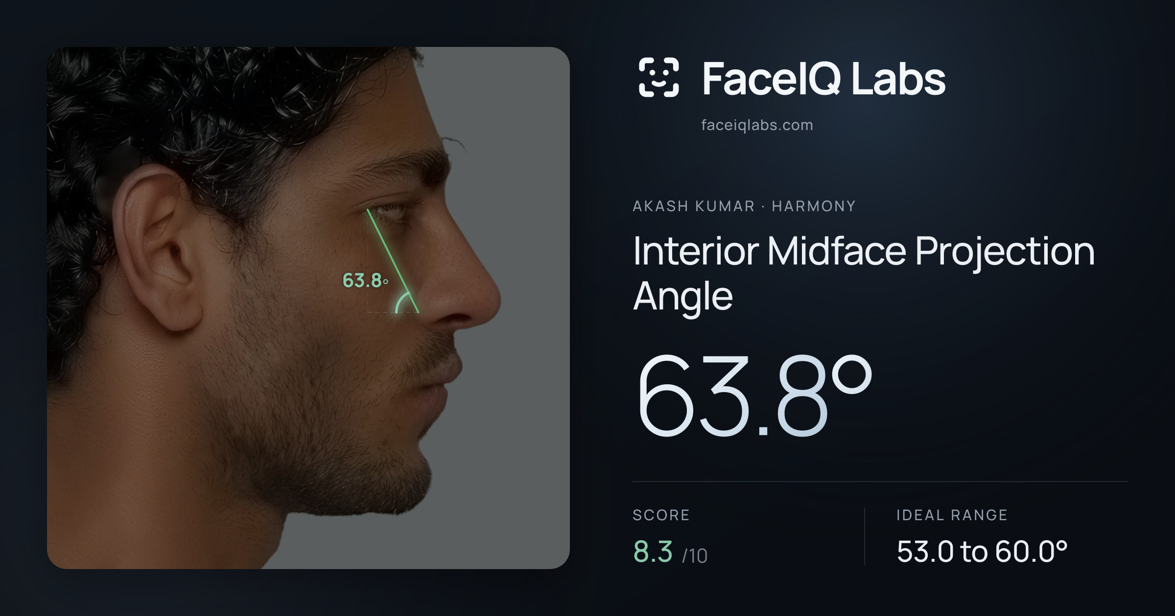 Akash Kumar Interior Midface Projection Angle: 63.8°, drawn on the photo