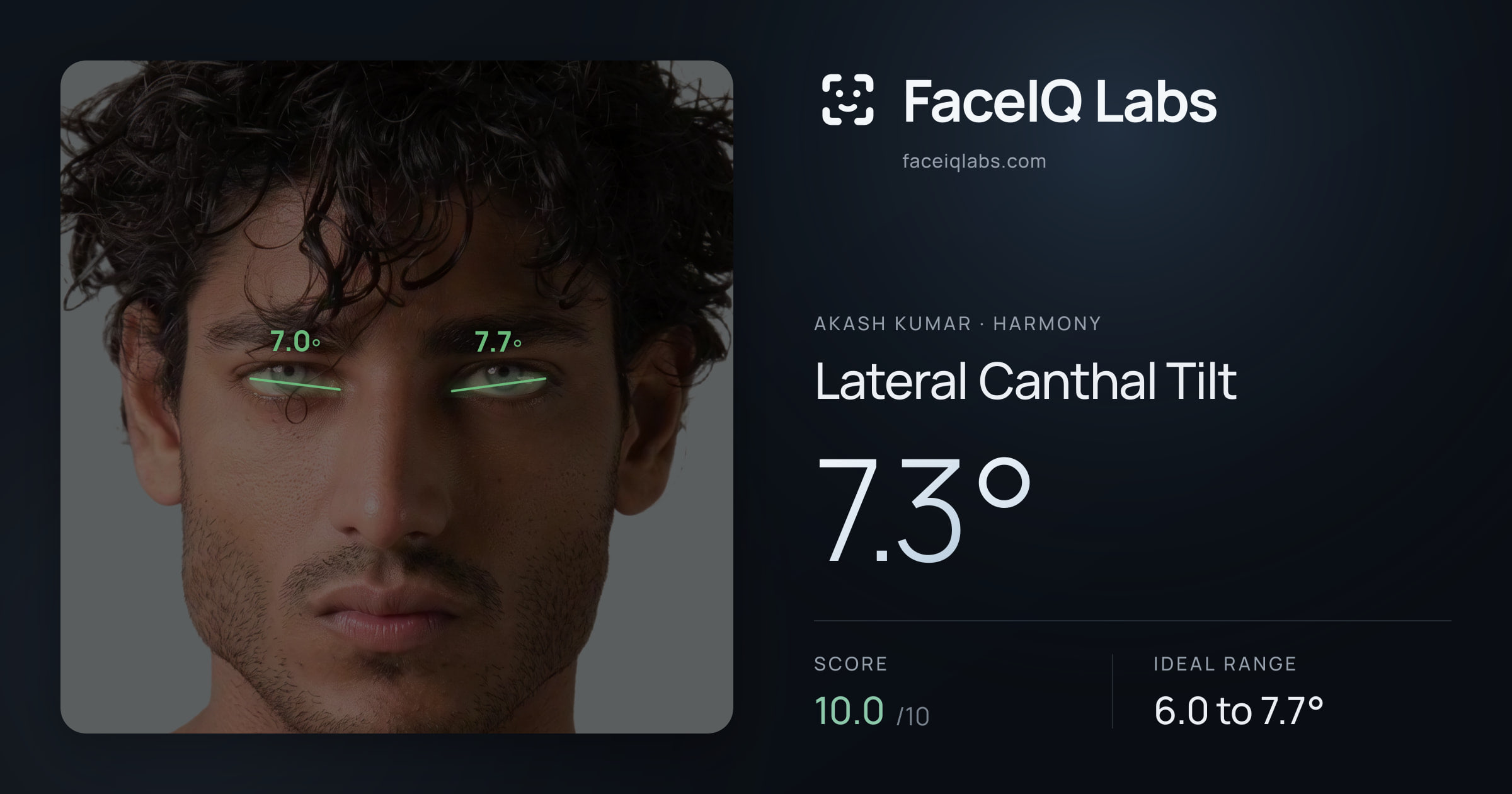 Akash Kumar Lateral Canthal Tilt: 7.3°, drawn on the photo