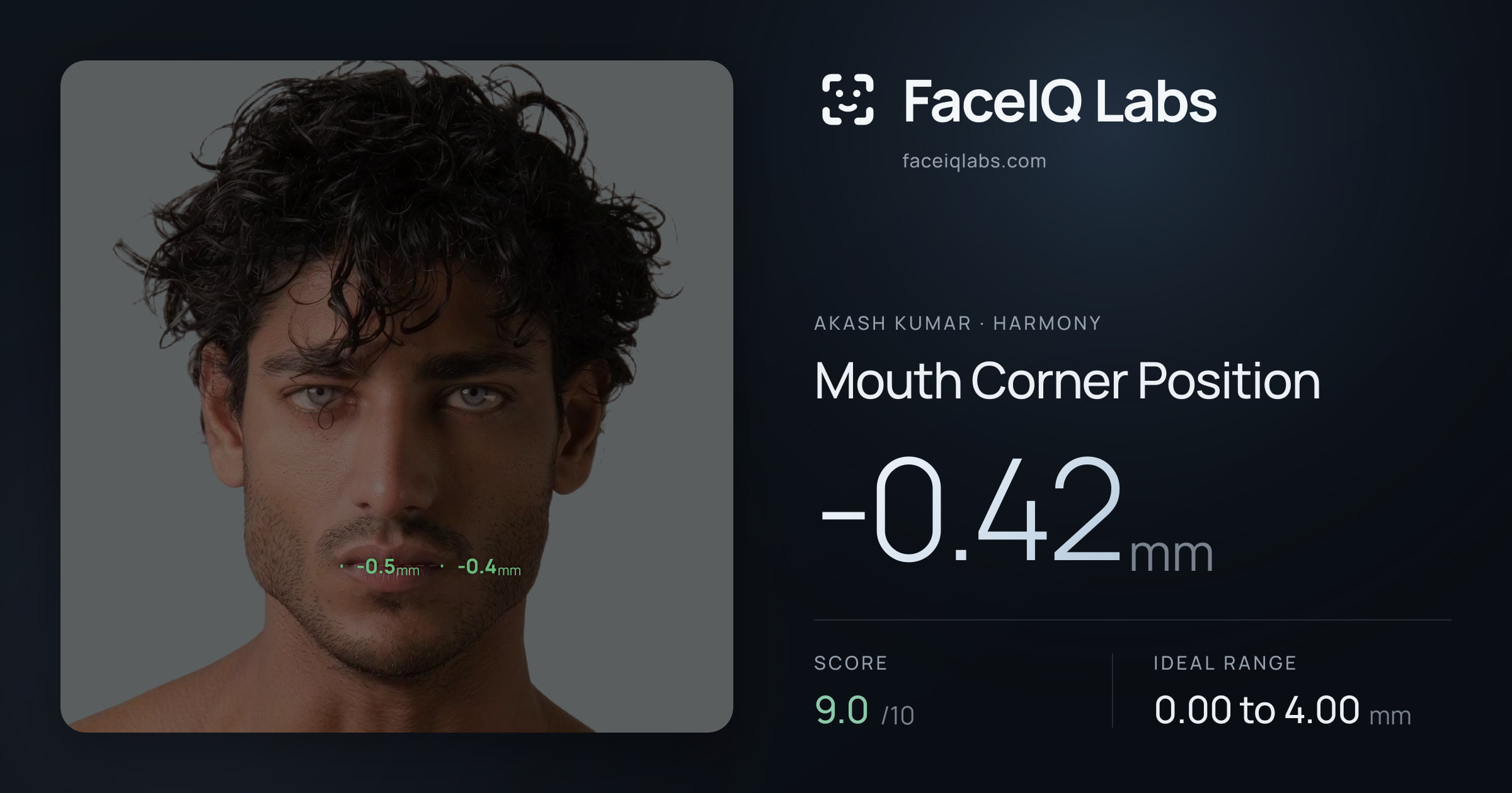 Akash Kumar Mouth Corner Position: -0.42mm, drawn on the photo