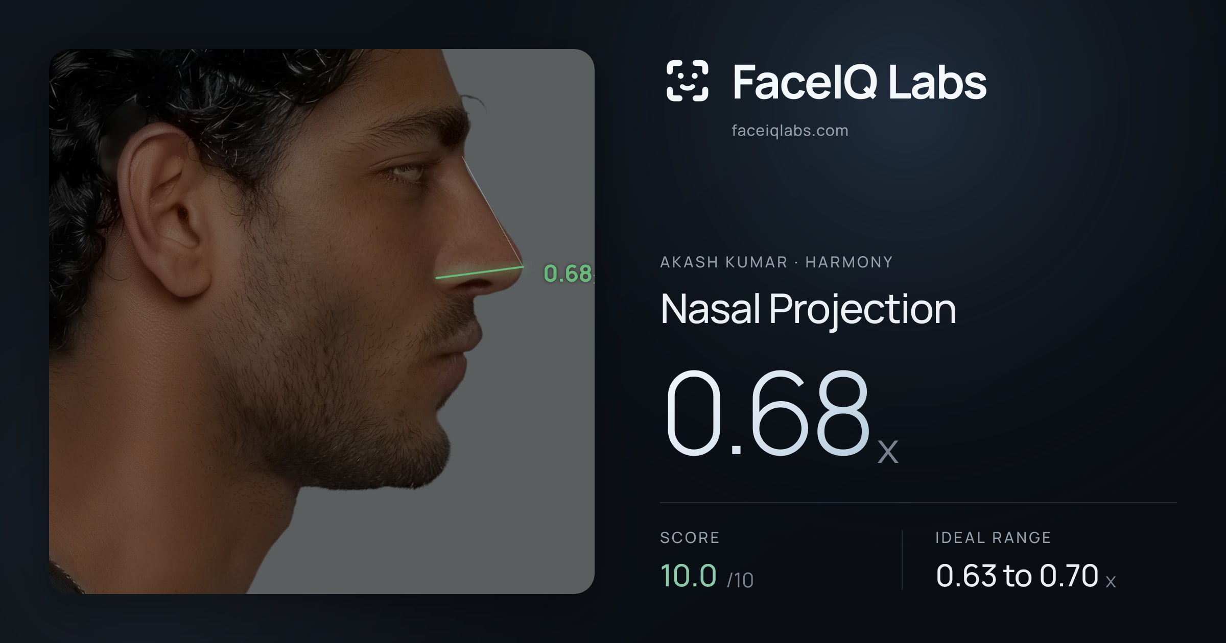Akash Kumar Nasal Projection: 0.68x, drawn on the photo