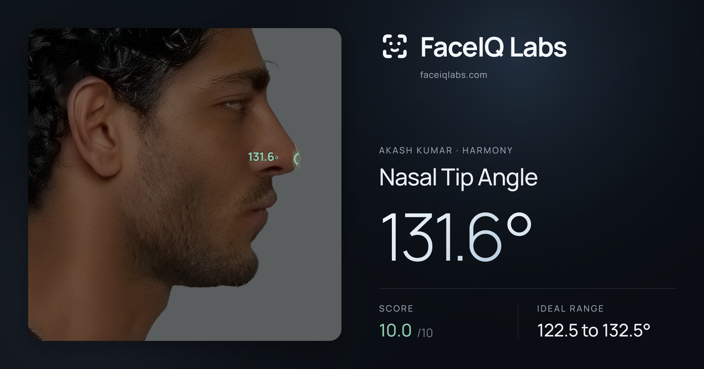 Akash Kumar Nasal Tip Angle: 131.6°, drawn on the photo