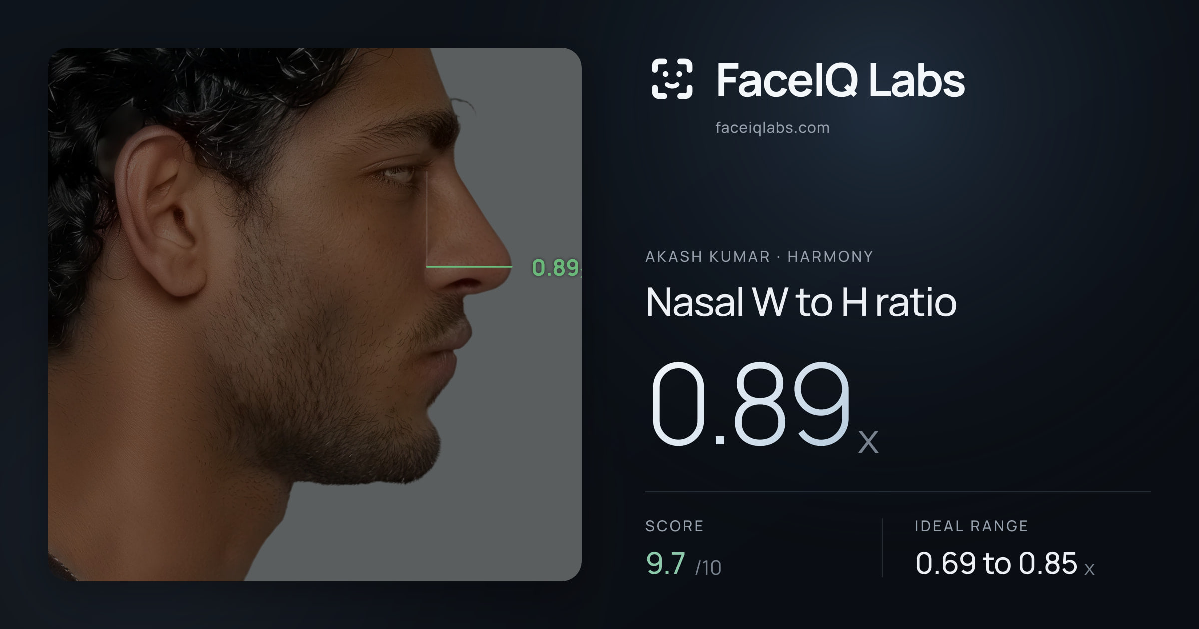 Akash Kumar Nasal W to H ratio: 0.89x, drawn on the photo