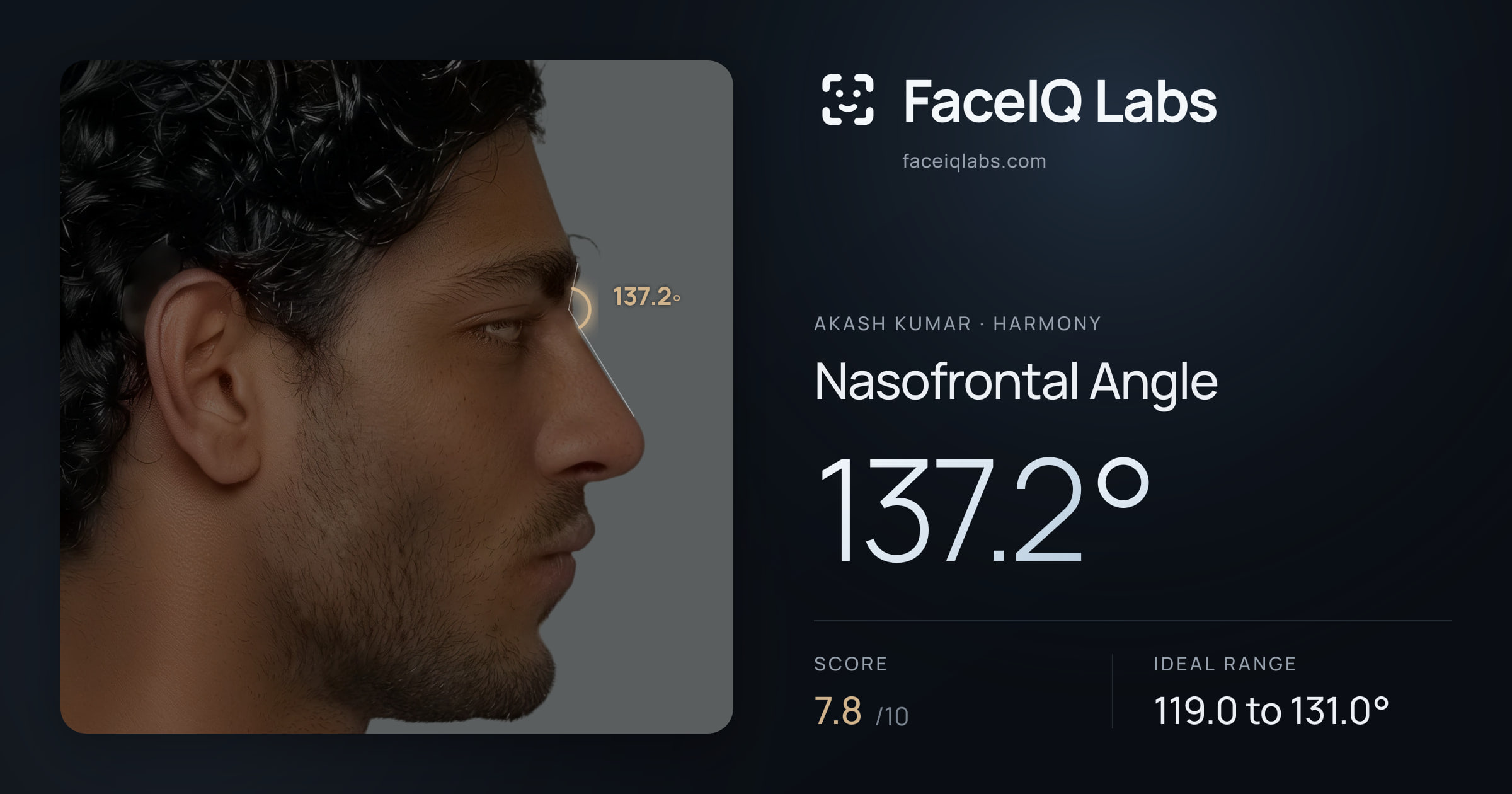 Akash Kumar Nasofrontal Angle: 137.2°, drawn on the photo
