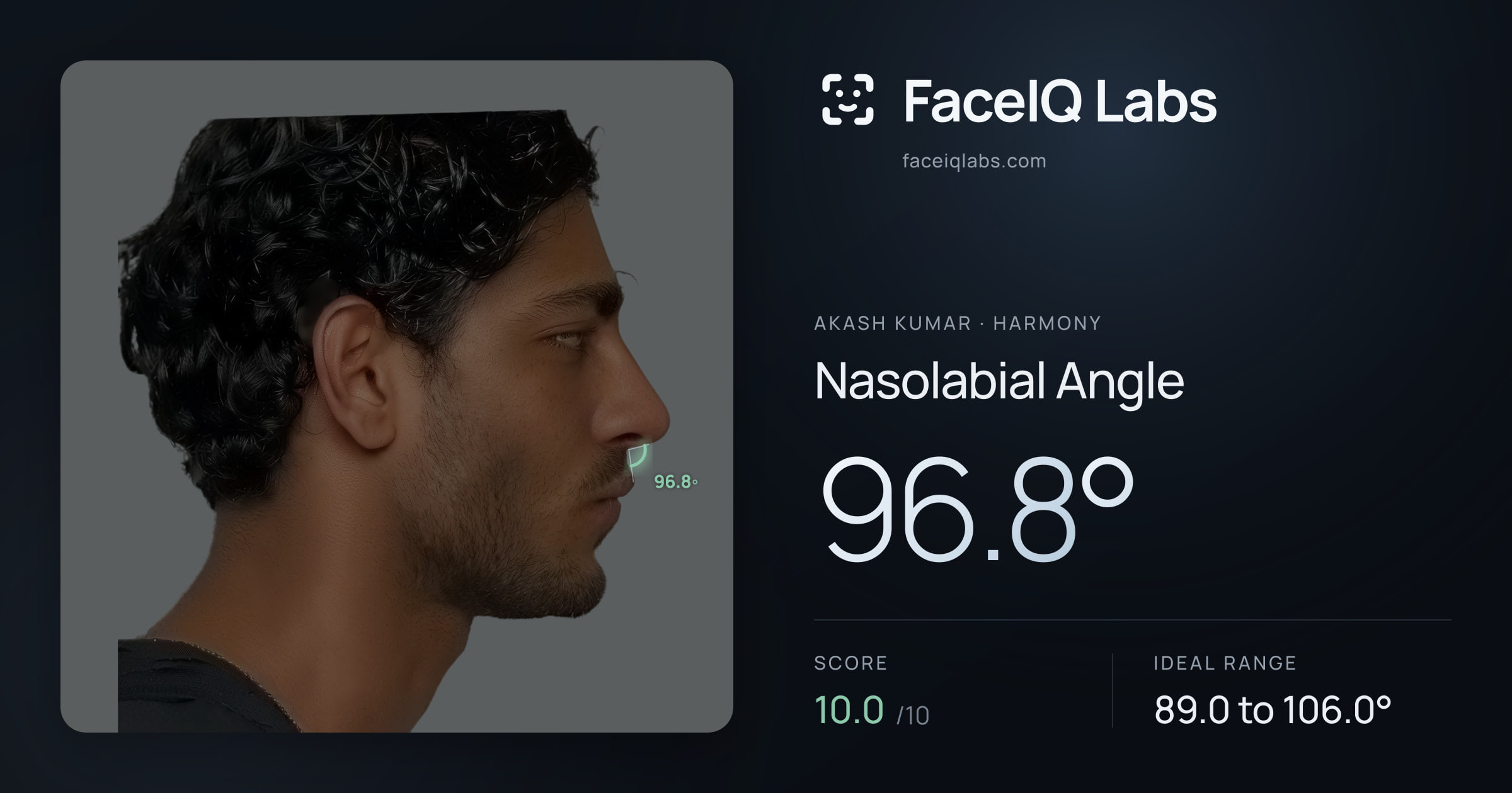 Akash Kumar Nasolabial Angle: 96.8°, drawn on the photo