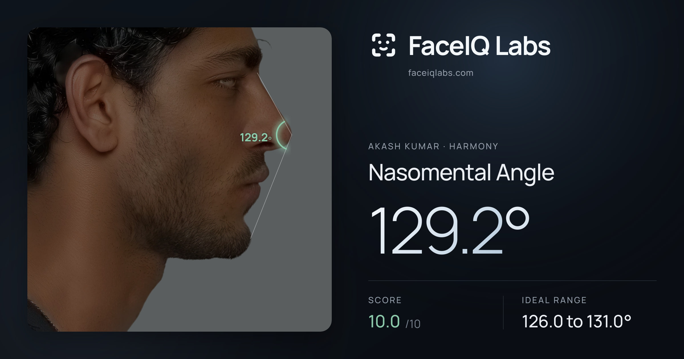 Akash Kumar Nasomental Angle: 129.2°, drawn on the photo