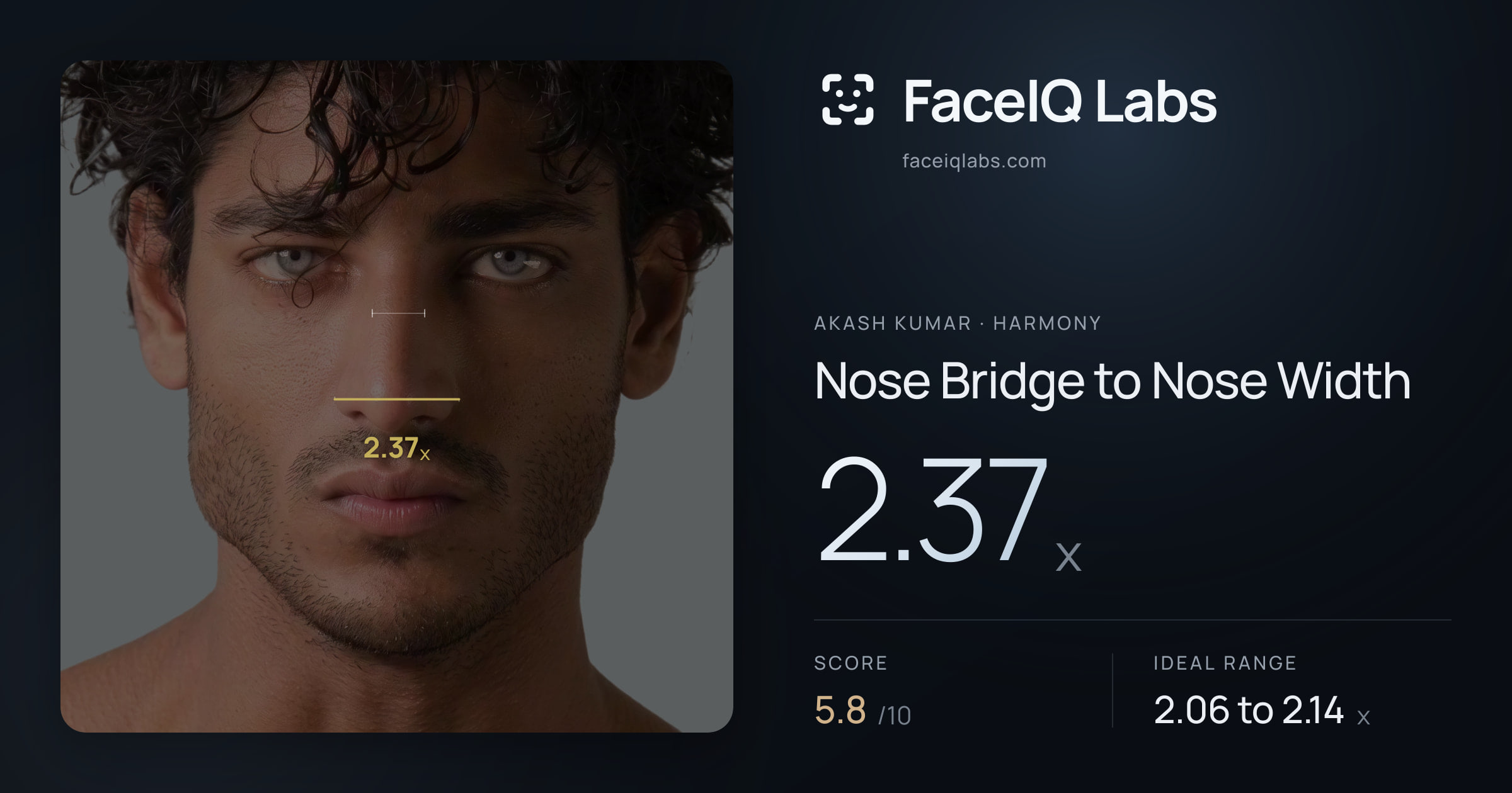 Akash Kumar Nose Bridge to Nose Width: 2.37x, drawn on the photo