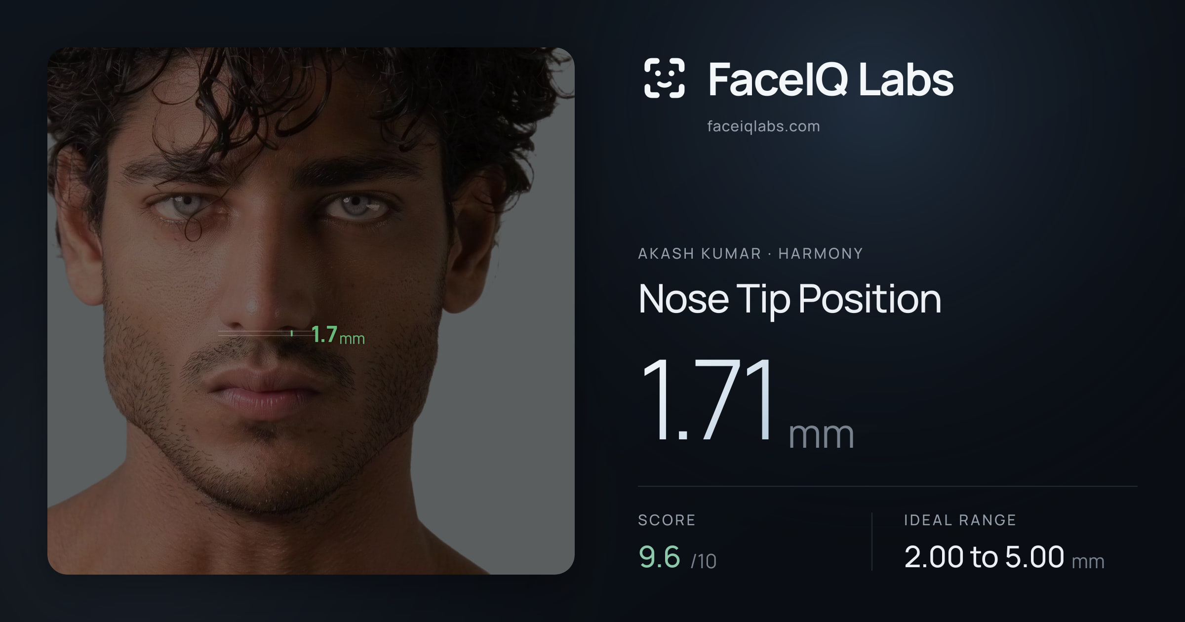 Akash Kumar Nose Tip Position: 1.71mm, drawn on the photo
