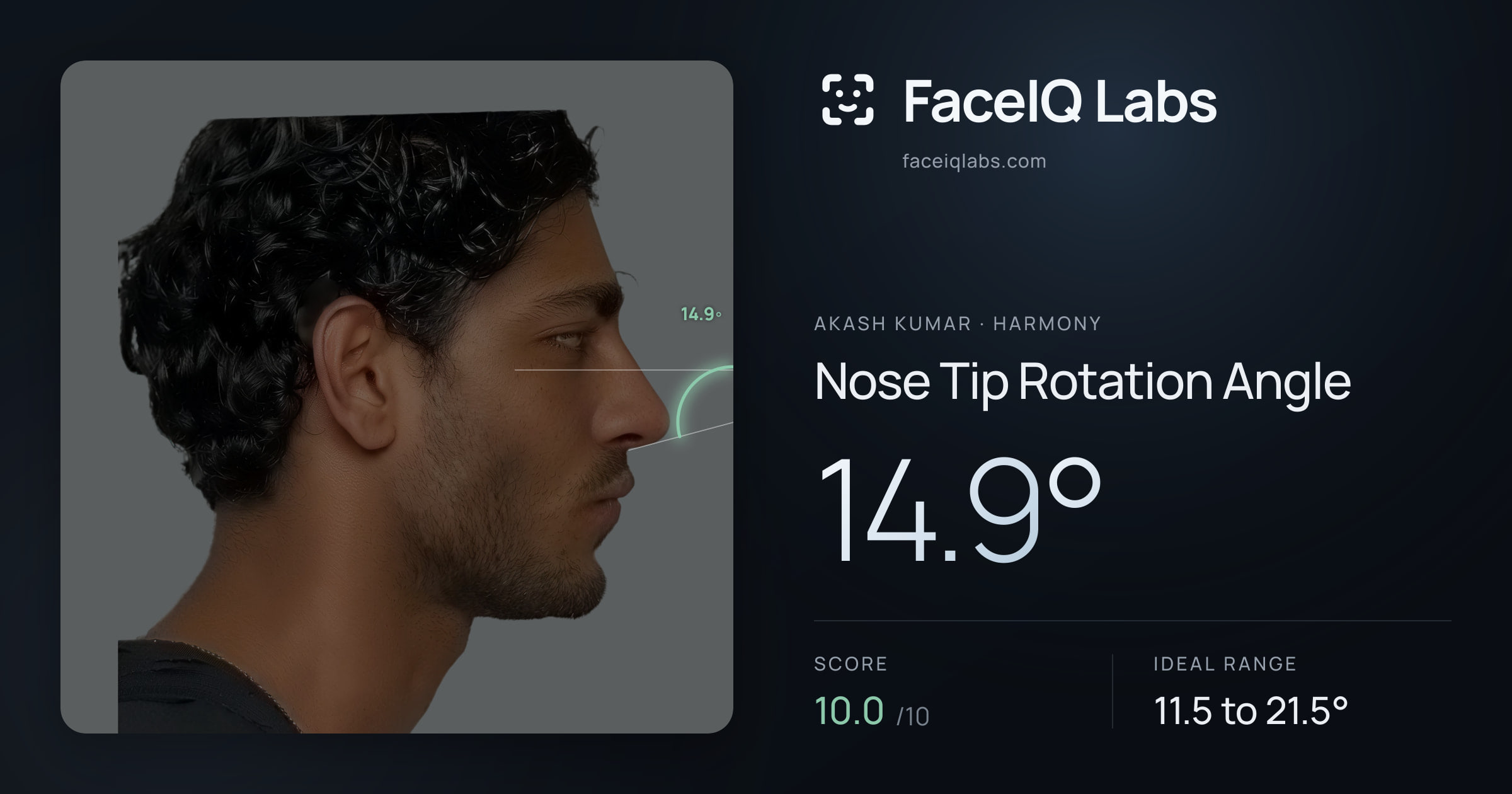 Akash Kumar Nose Tip Rotation Angle: 14.9°, drawn on the photo