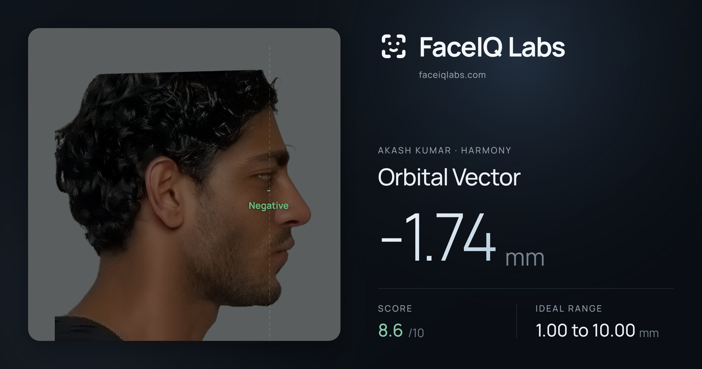 Akash Kumar Orbital Vector: -1.74mm, drawn on the photo