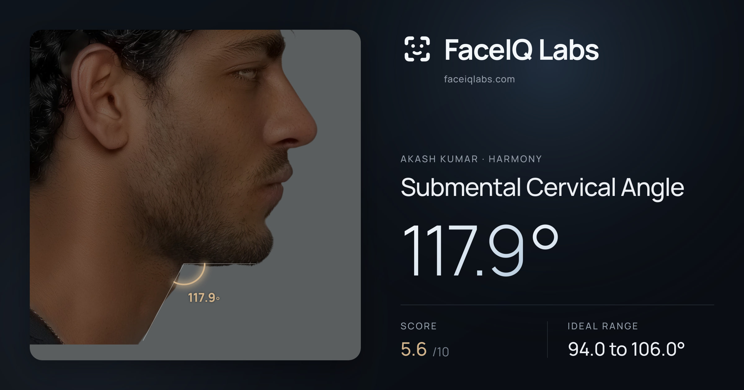 Akash Kumar Submental Cervical Angle: 117.9°, drawn on the photo