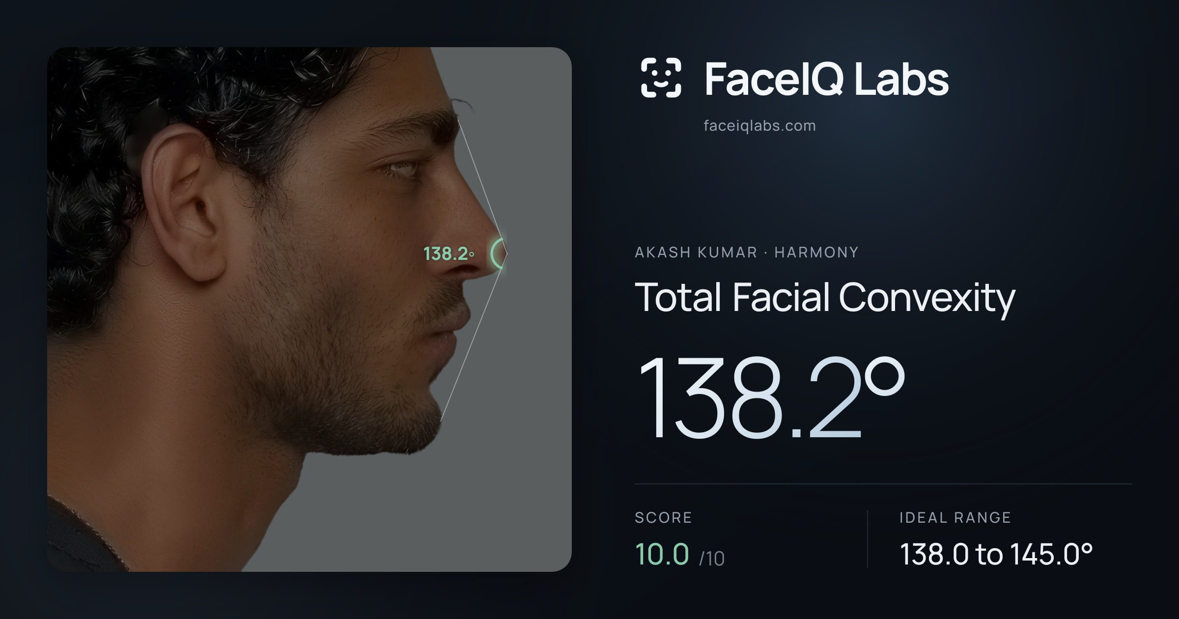 Akash Kumar Total Facial Convexity: 138.2°, drawn on the photo