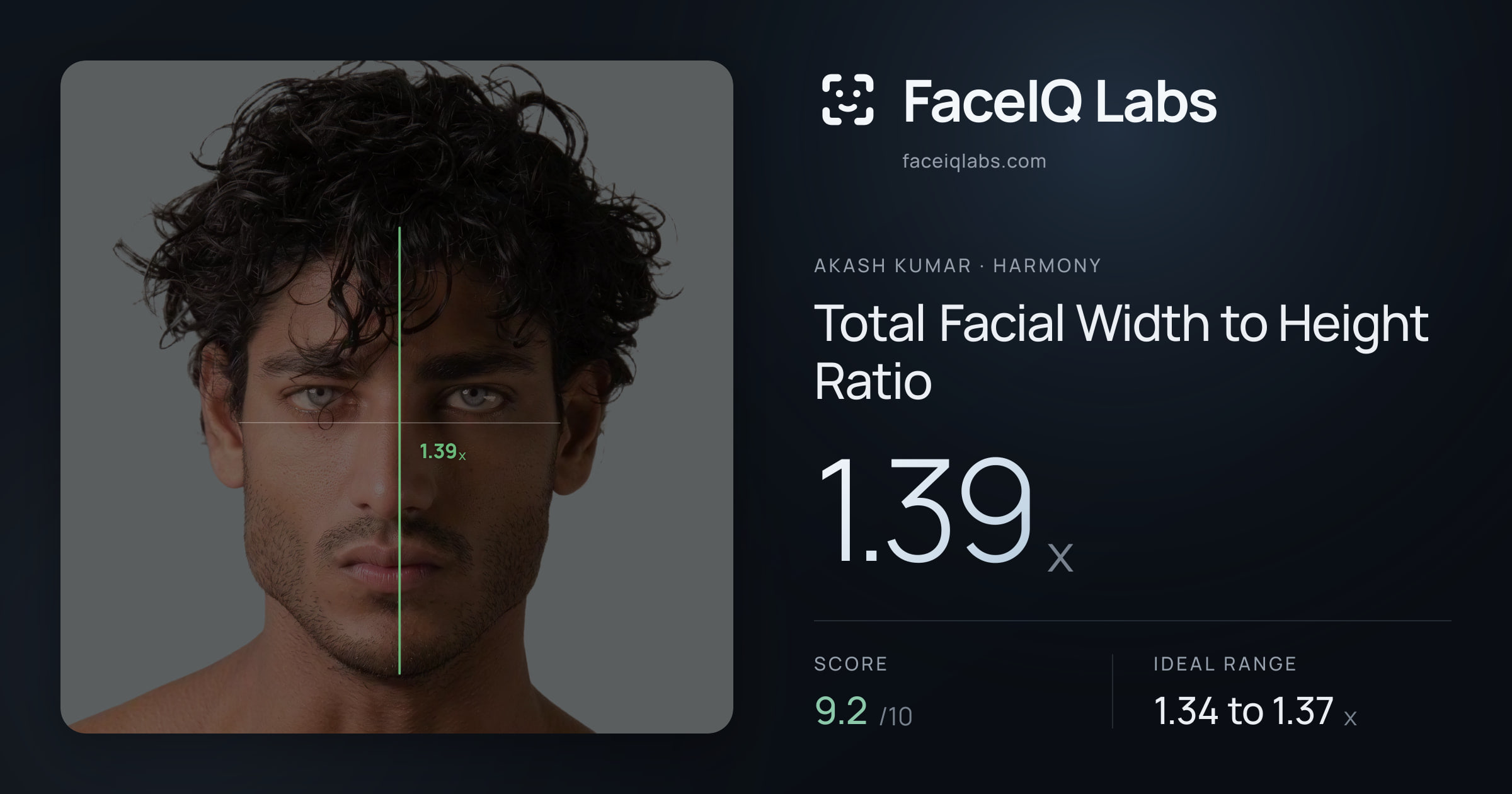 Akash Kumar Total Facial Width to Height Ratio: 1.39x, drawn on the photo