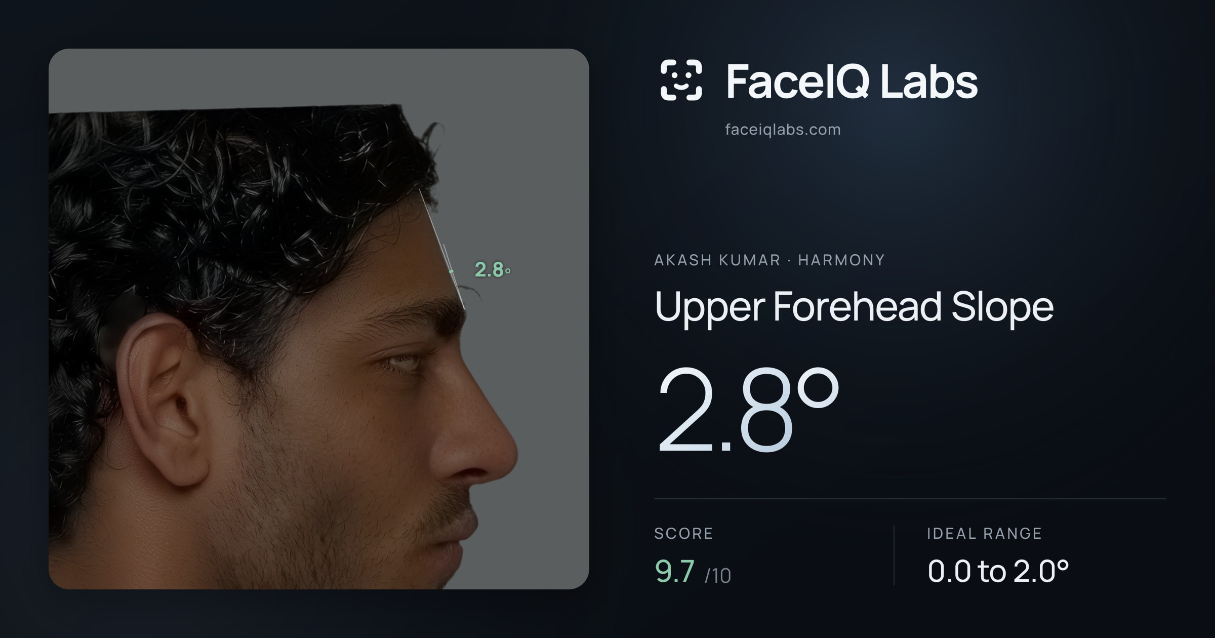 Akash Kumar Upper Forehead Slope: 2.8°, drawn on the photo