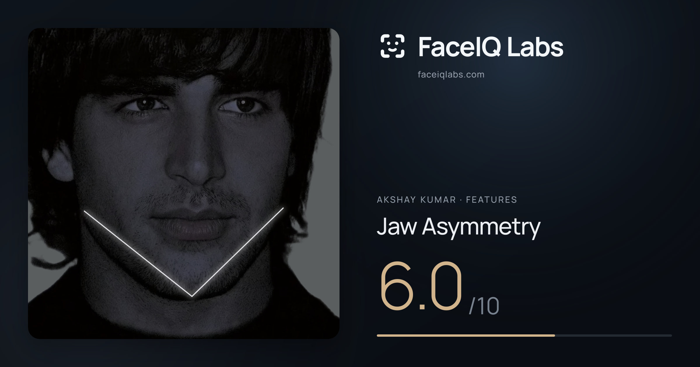Akshay Kumar Jaw Asymmetry: 6.0/10, drawn on the photo