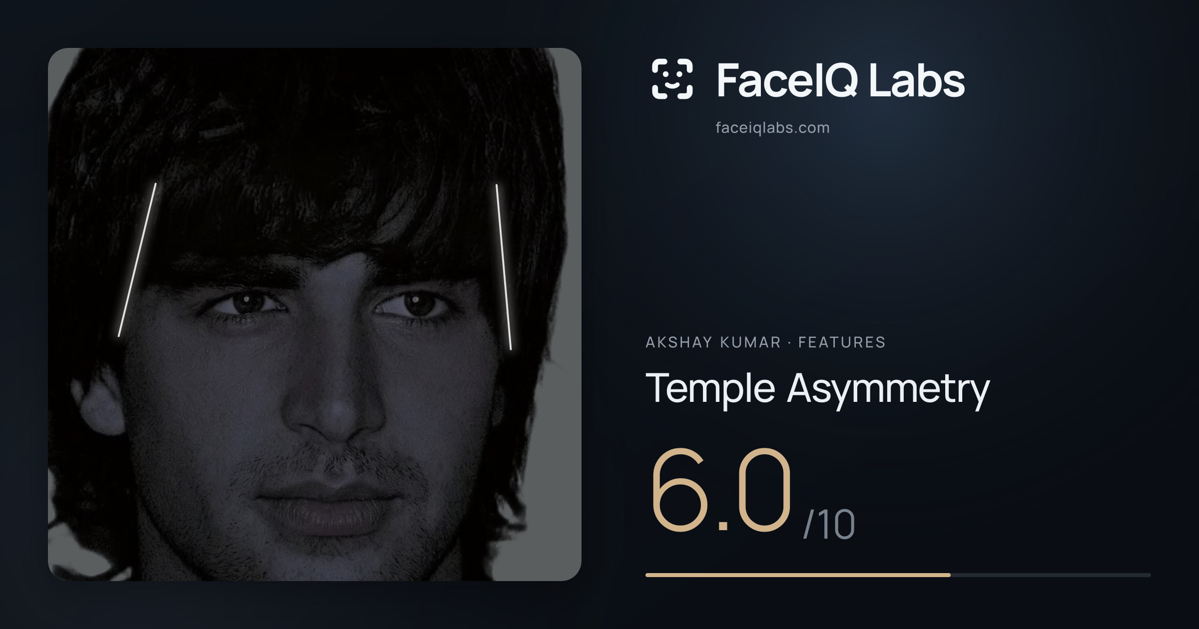 Akshay Kumar Temple Asymmetry: 6.0/10, drawn on the photo