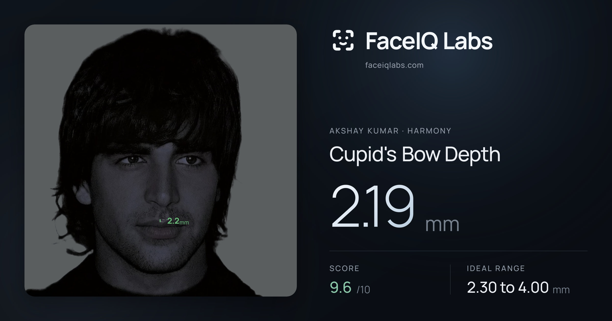 Akshay Kumar Cupid's Bow Depth: 2.19mm, drawn on the photo
