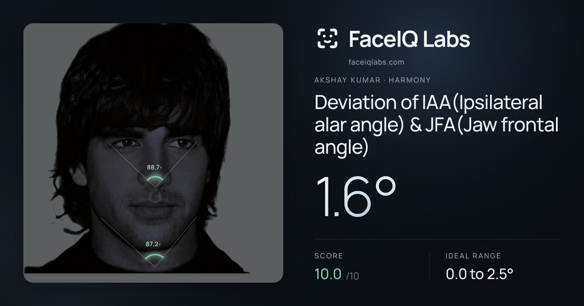 Akshay Kumar Deviation of IAA(Ipsilateral alar angle) & JFA(Jaw frontal angle): 1.6°, drawn on the photo