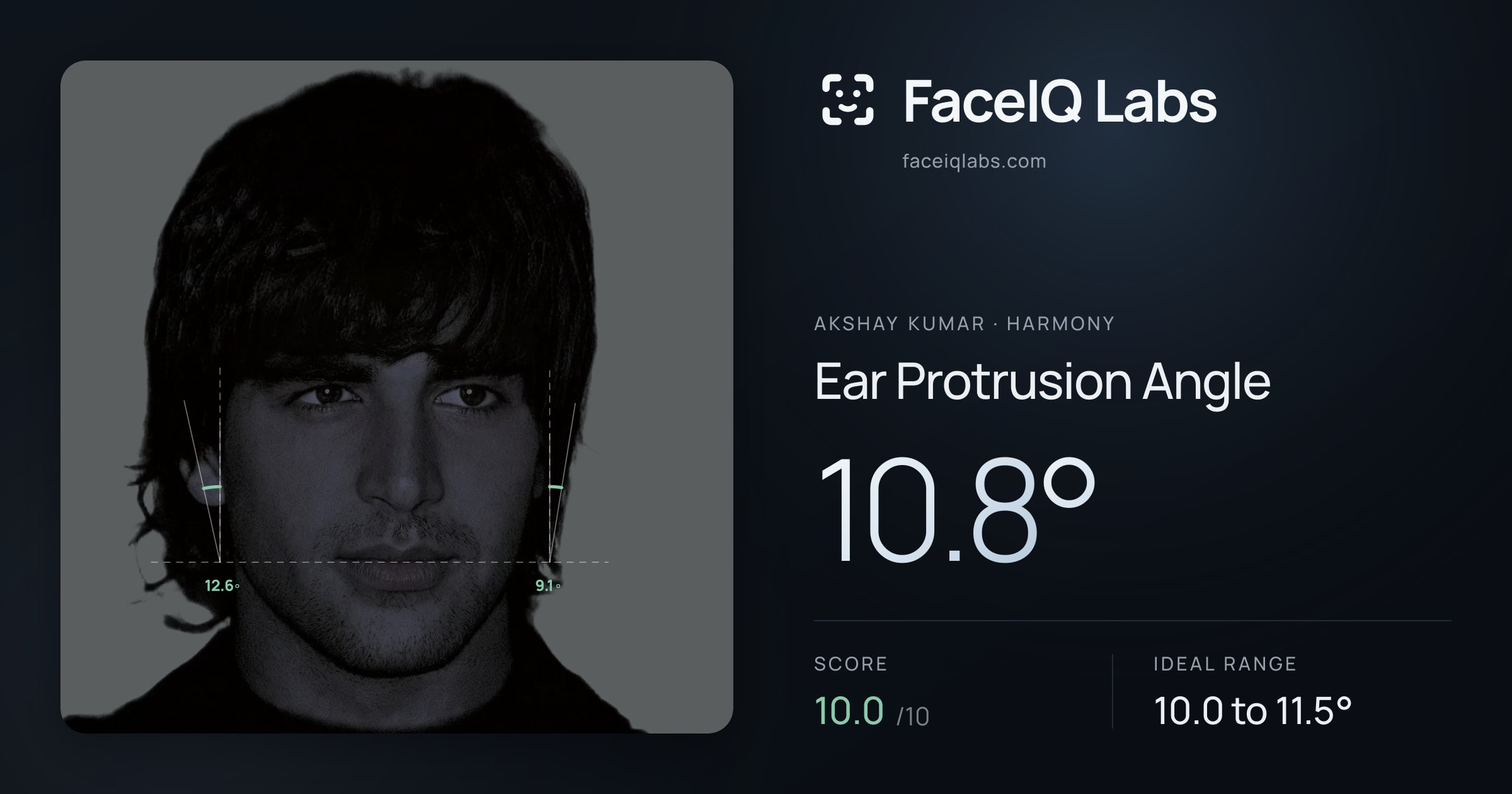 Akshay Kumar Ear Protrusion Angle: 10.8°, drawn on the photo