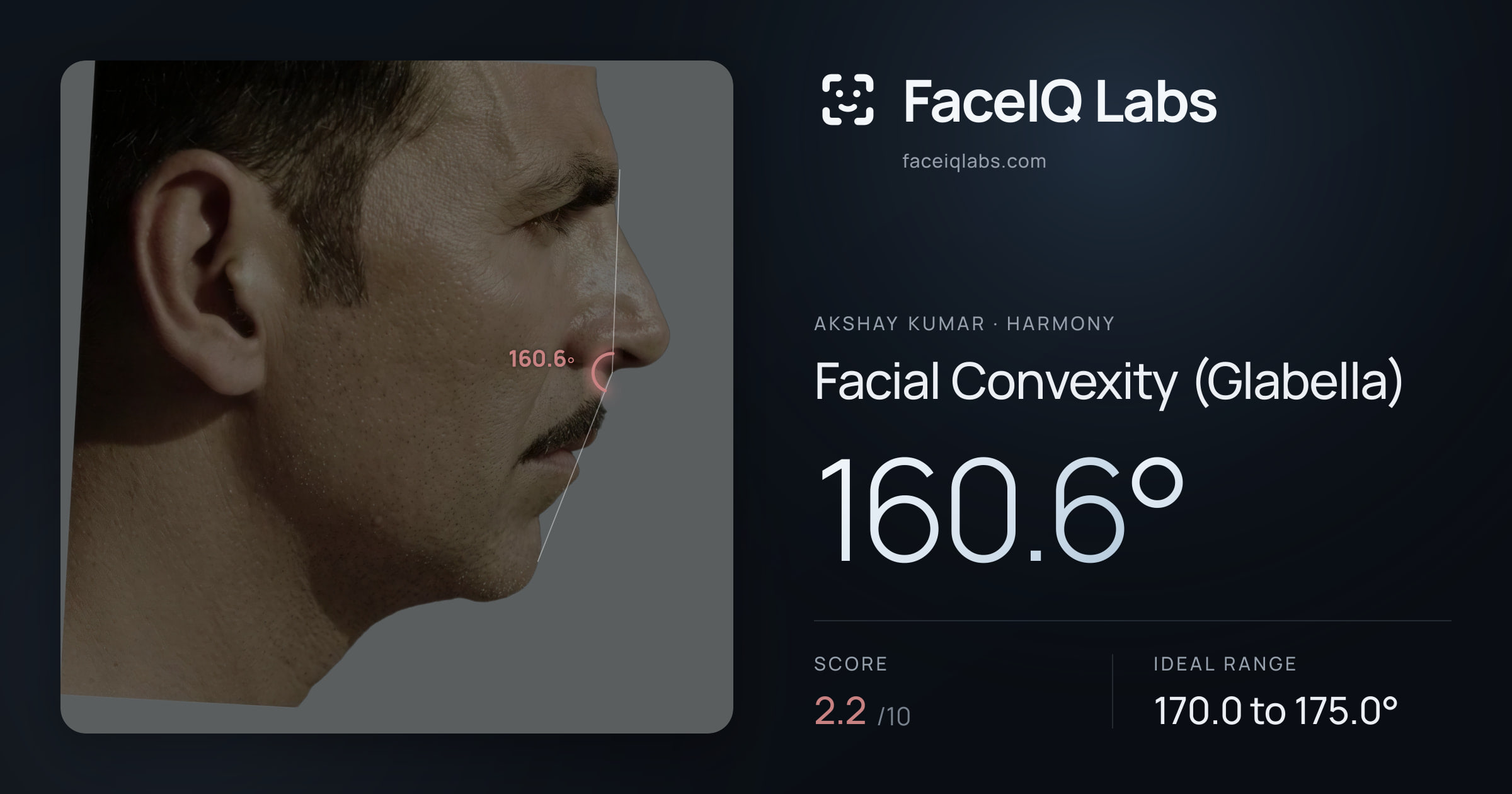 Akshay Kumar Facial Convexity (Glabella): 160.6°, drawn on the photo