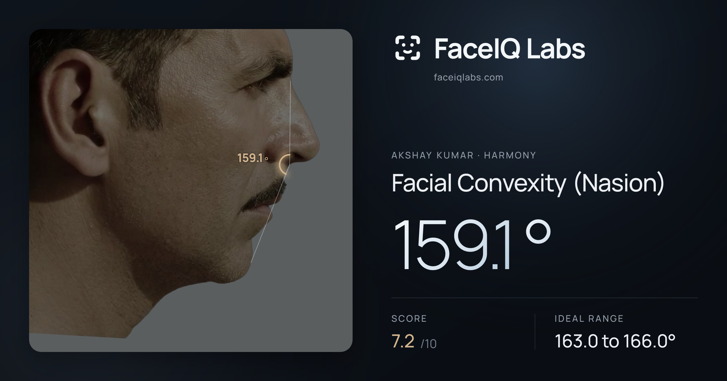 Akshay Kumar Facial Convexity (Nasion): 159.1°, drawn on the photo