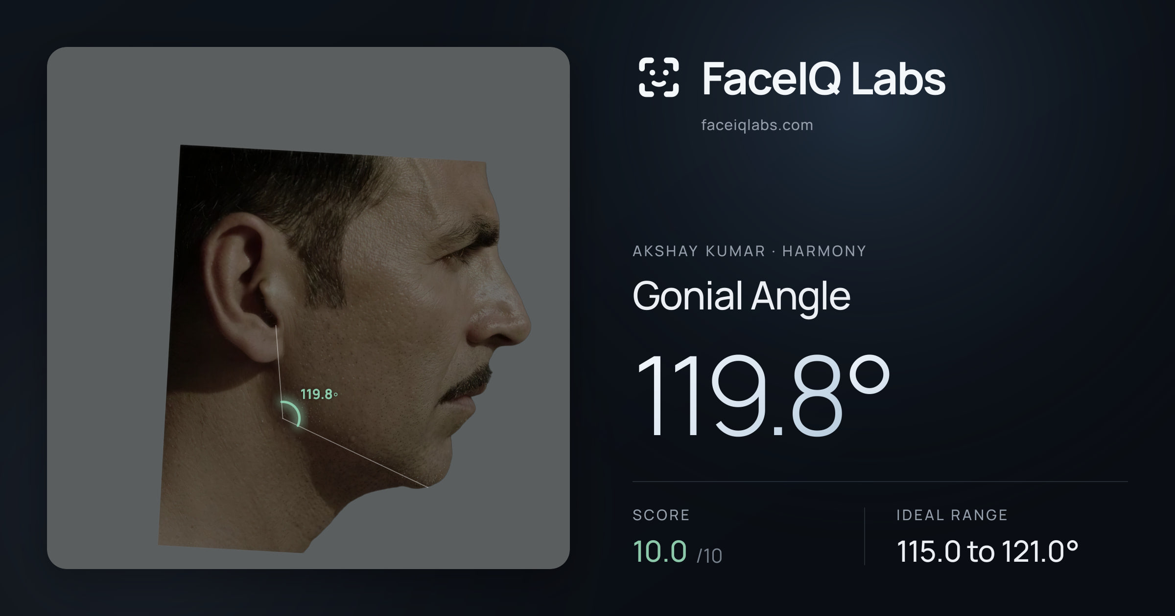 Akshay Kumar Gonial Angle: 119.8°, drawn on the photo