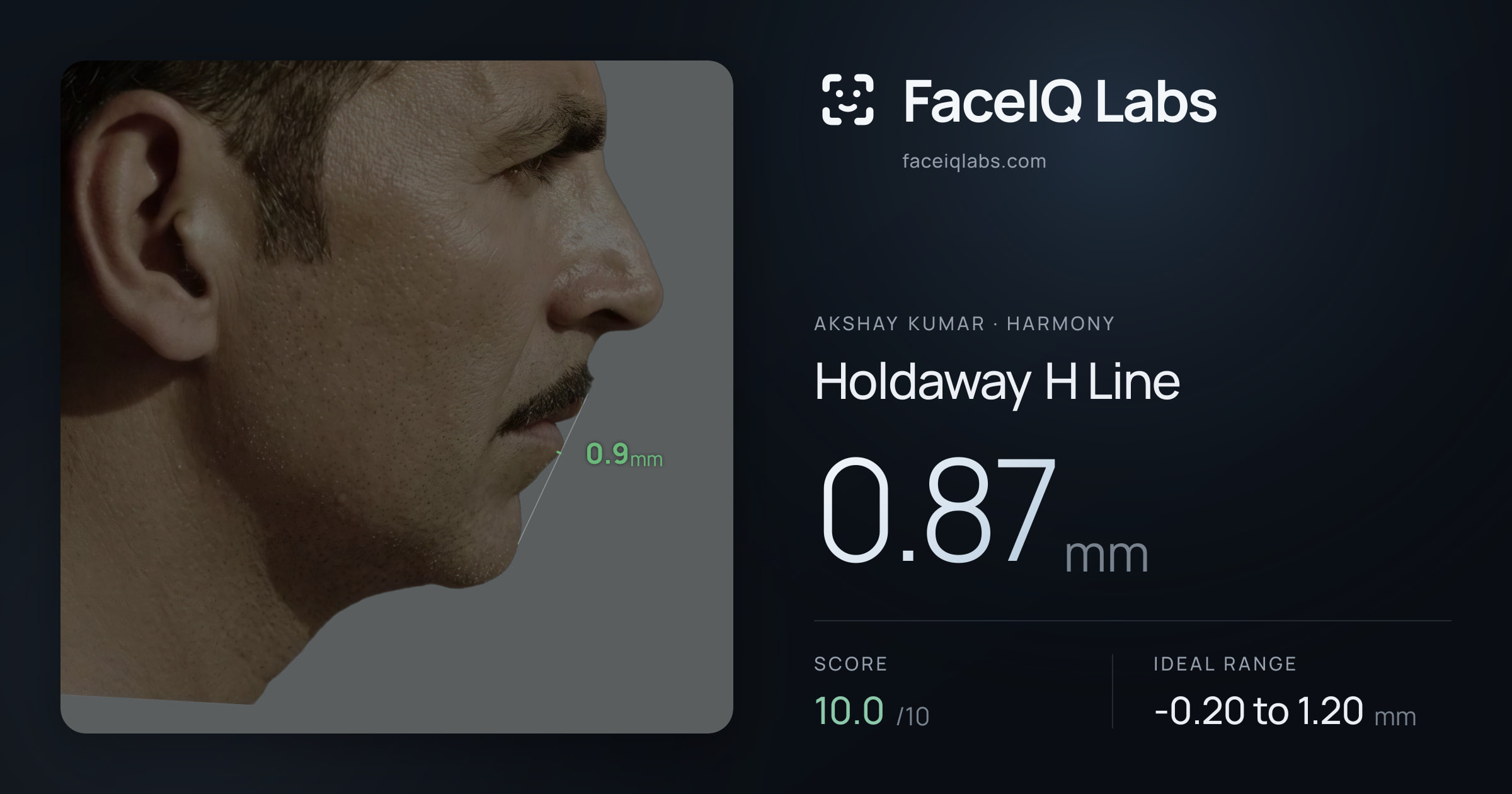 Akshay Kumar Holdaway H Line: 0.87mm, drawn on the photo