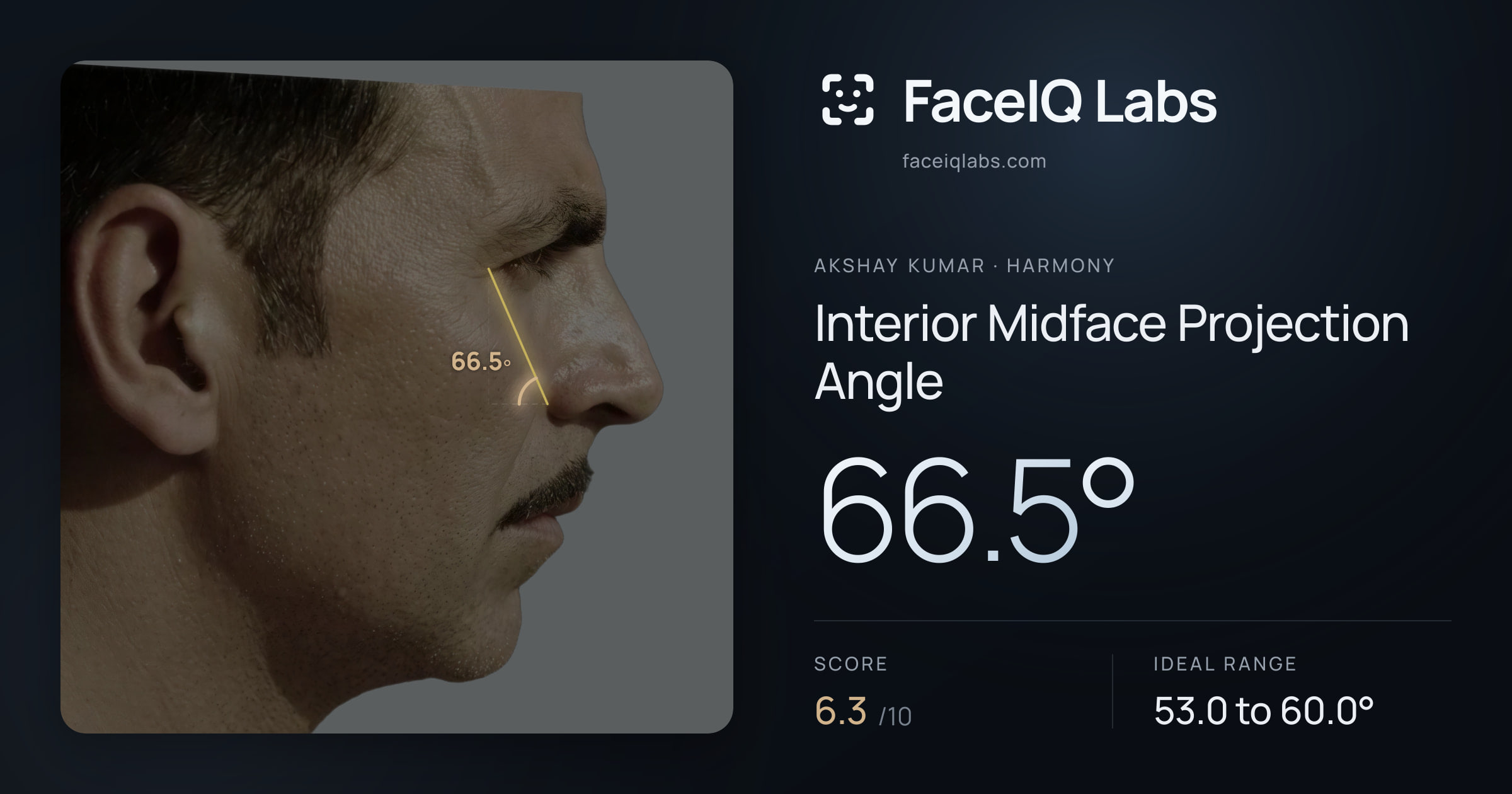 Akshay Kumar Interior Midface Projection Angle: 66.5°, drawn on the photo