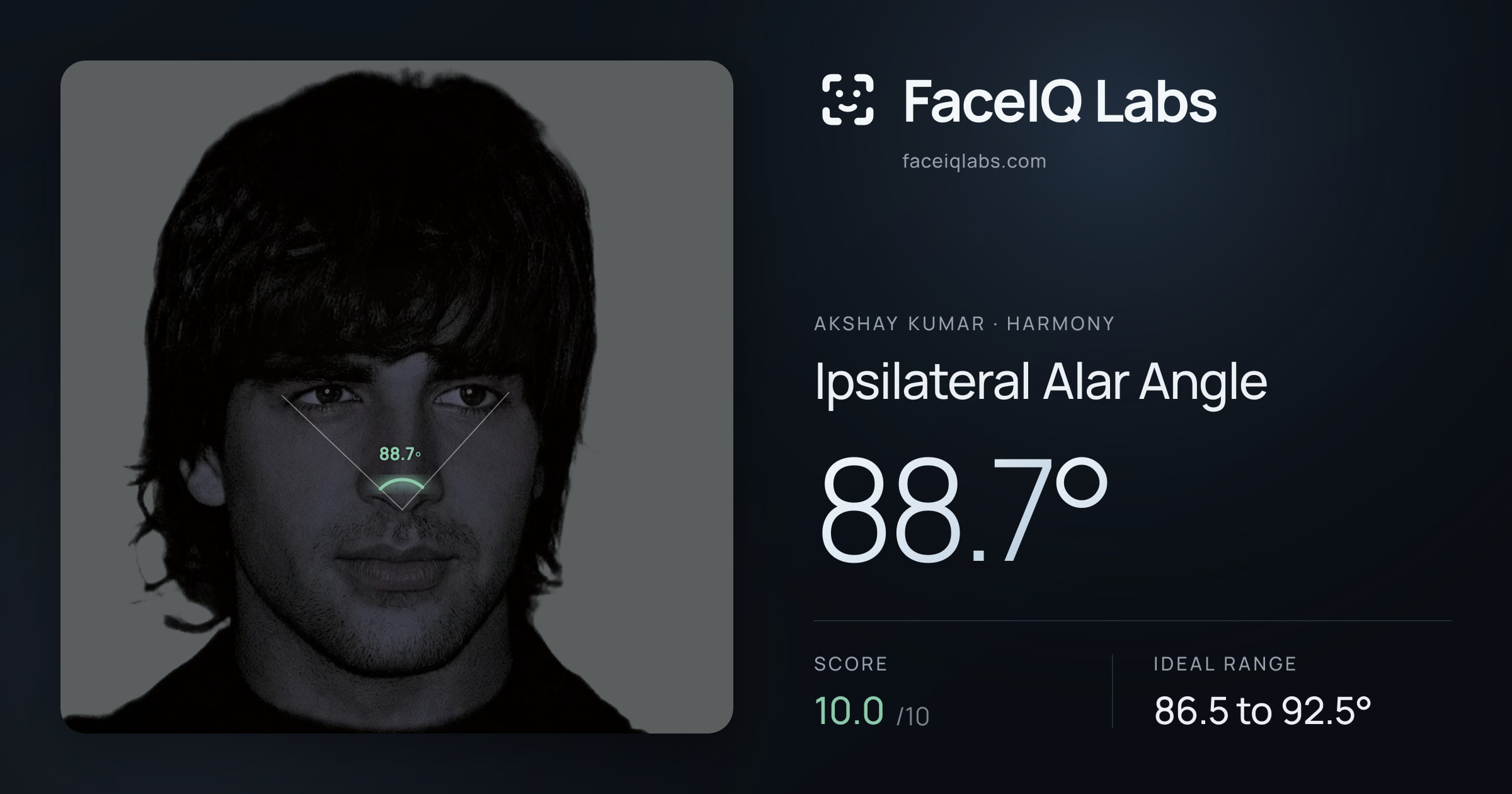 Akshay Kumar Ipsilateral Alar Angle: 88.7°, drawn on the photo