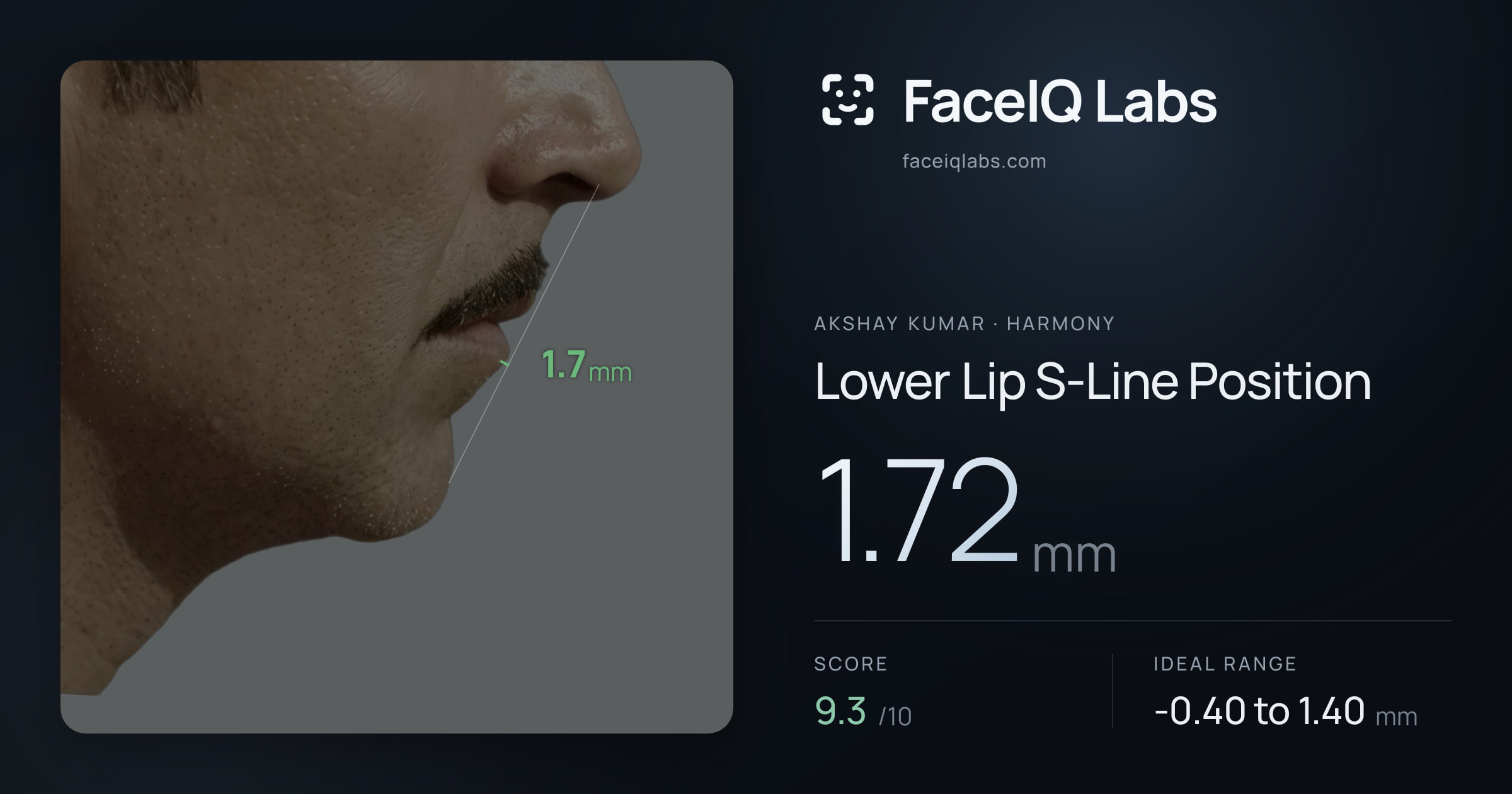 Akshay Kumar Lower Lip S-Line Position: 1.72mm, drawn on the photo