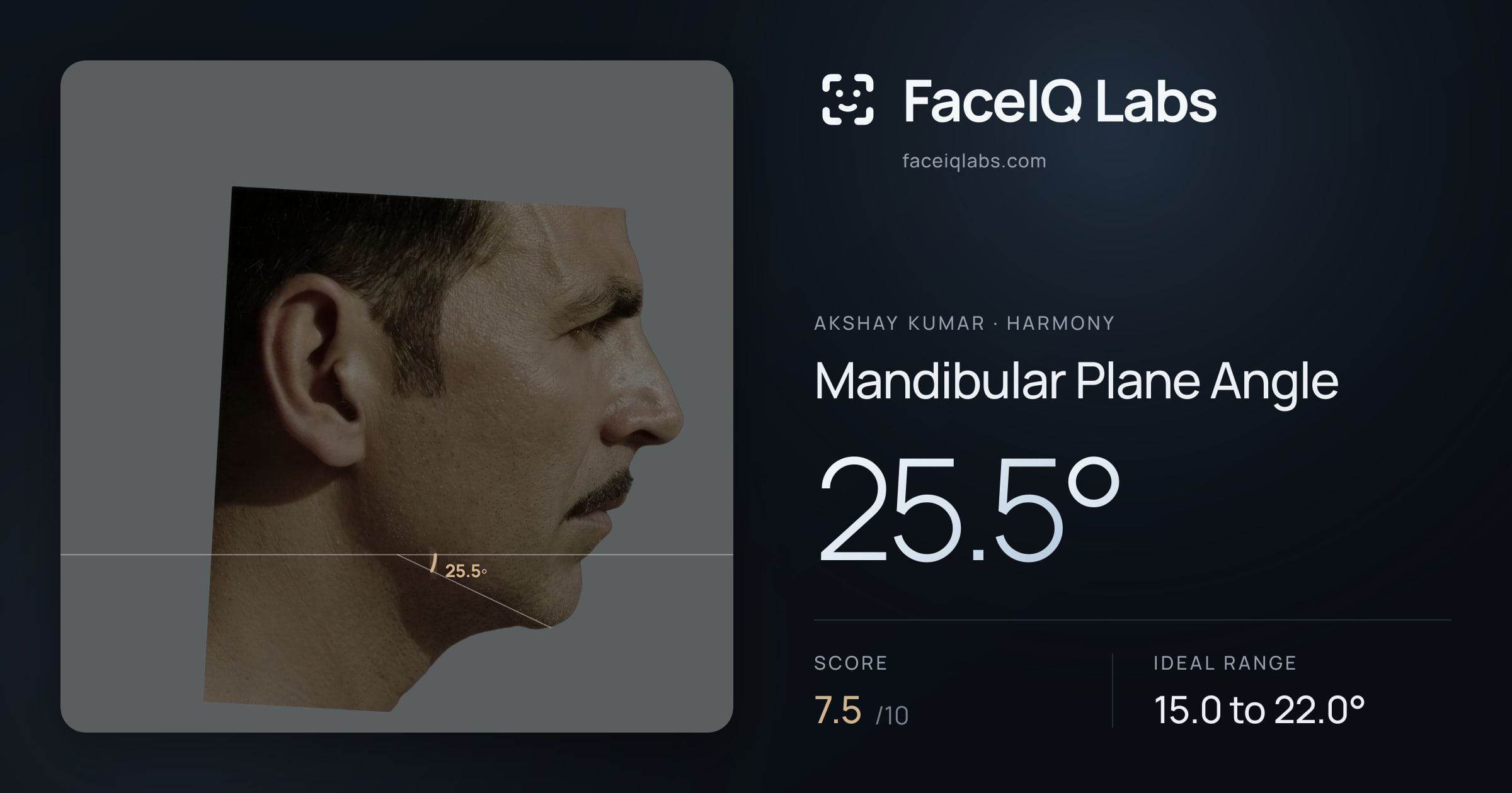 Akshay Kumar Mandibular Plane Angle: 25.5°, drawn on the photo