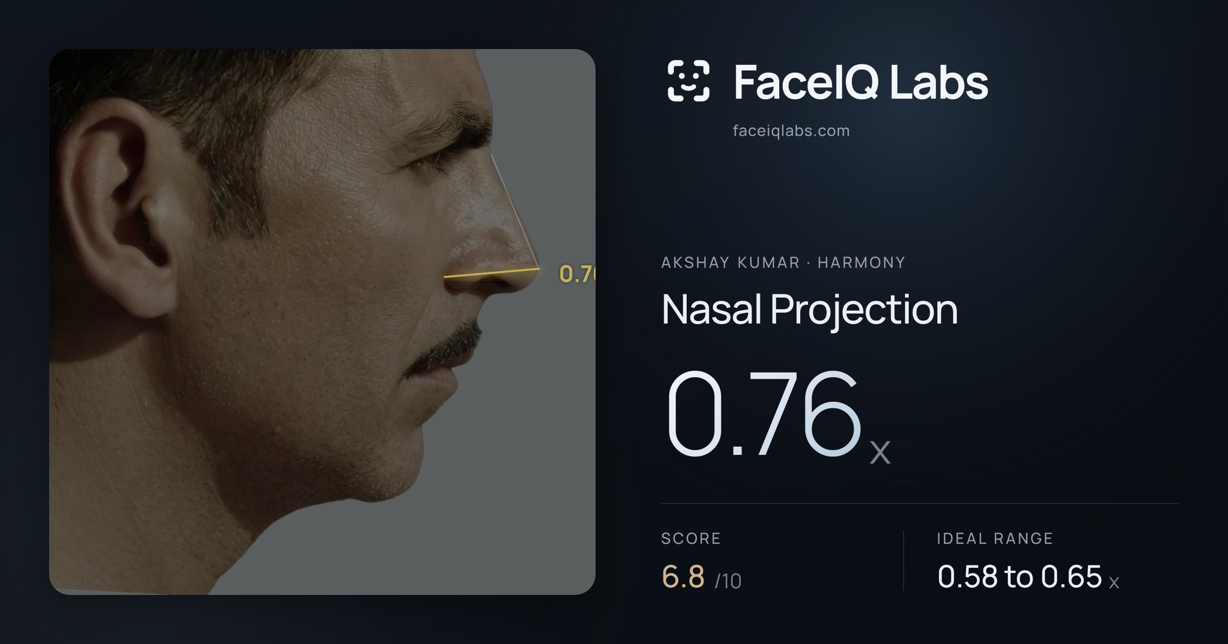 Akshay Kumar Nasal Projection: 0.76x, drawn on the photo