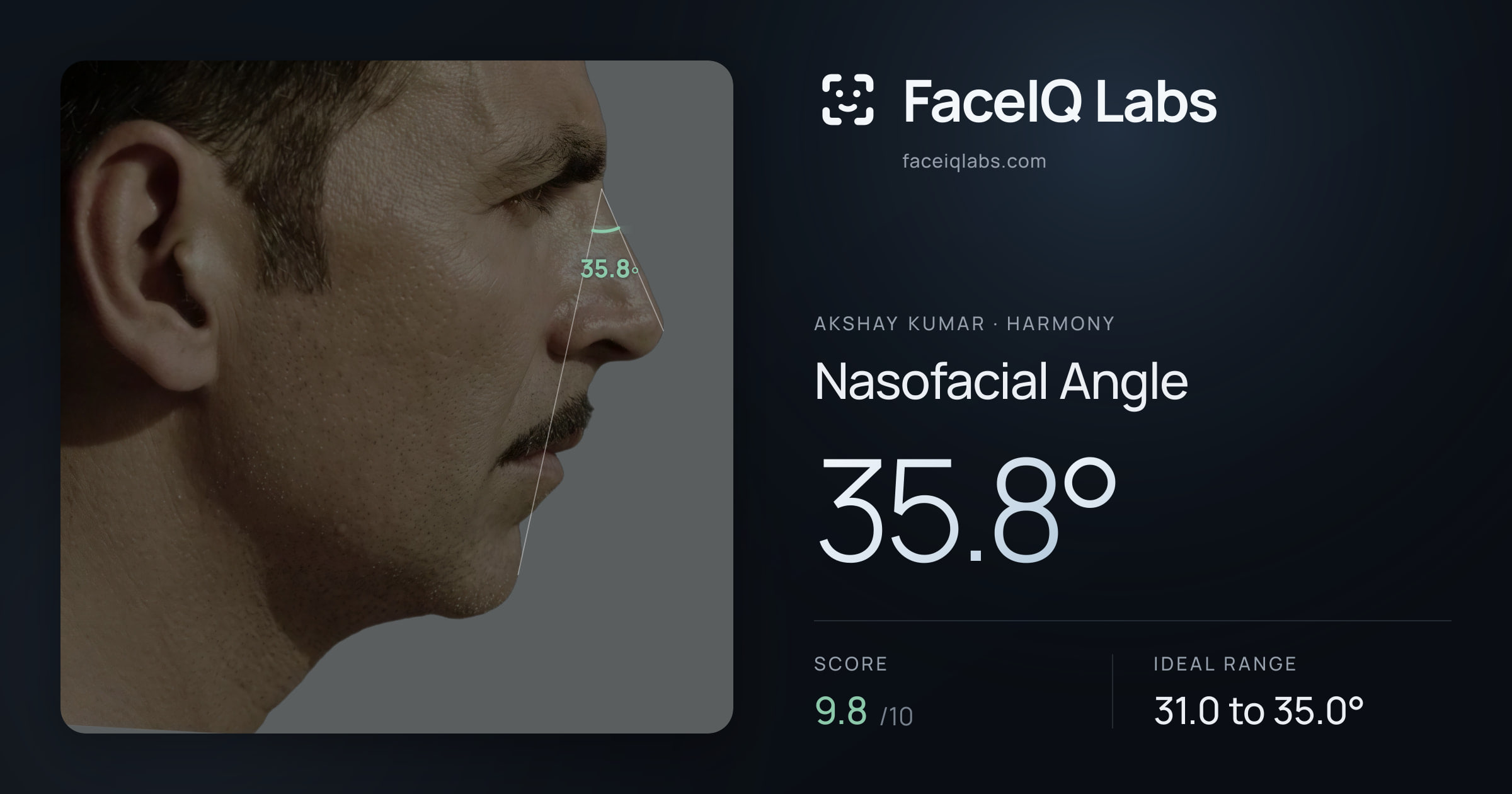 Akshay Kumar Nasofacial Angle: 35.8°, drawn on the photo