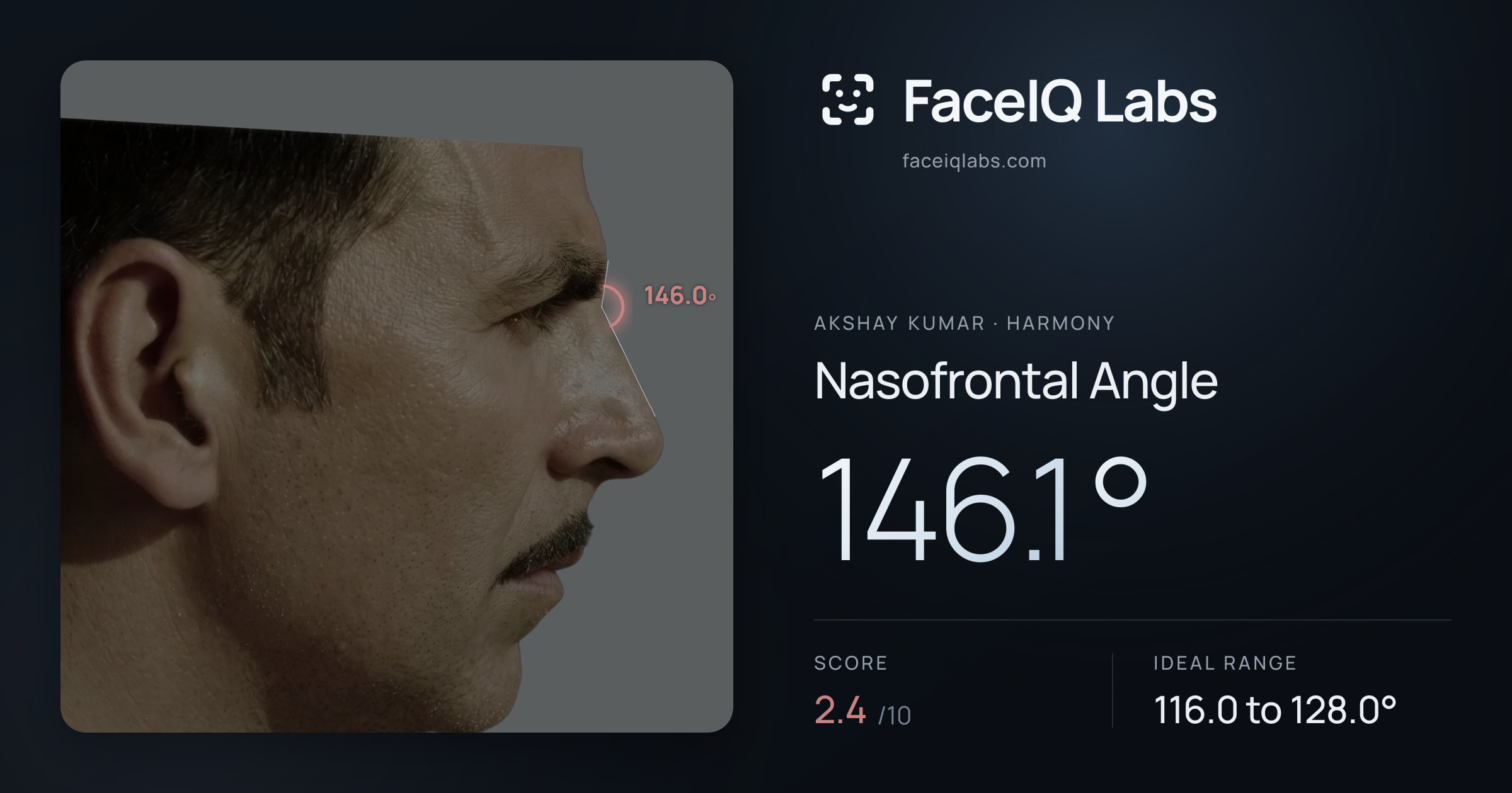 Akshay Kumar Nasofrontal Angle: 146.1°, drawn on the photo