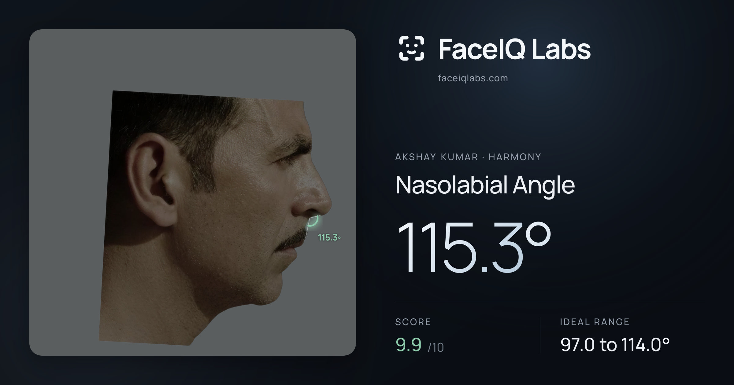Akshay Kumar Nasolabial Angle: 115.3°, drawn on the photo
