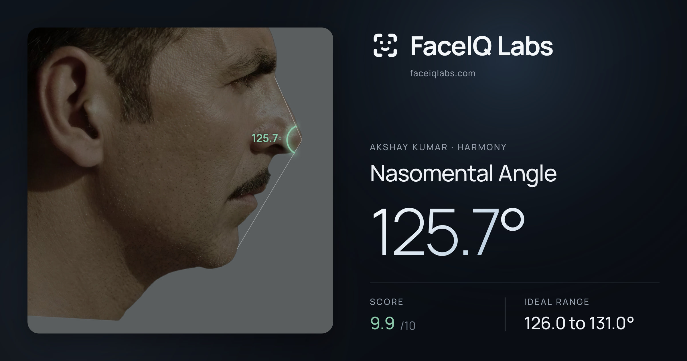 Akshay Kumar Nasomental Angle: 125.7°, drawn on the photo