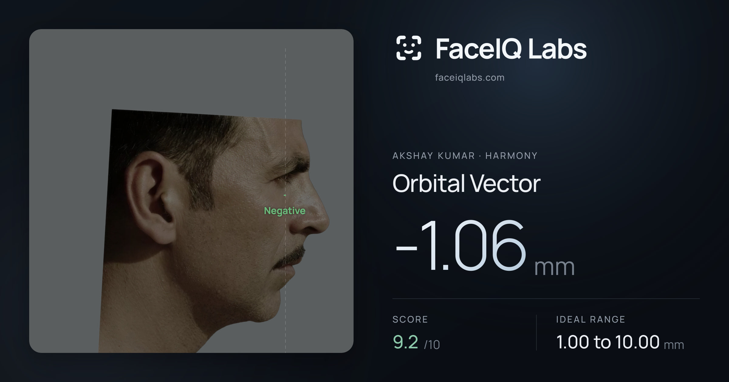 Akshay Kumar Orbital Vector: -1.06mm, drawn on the photo