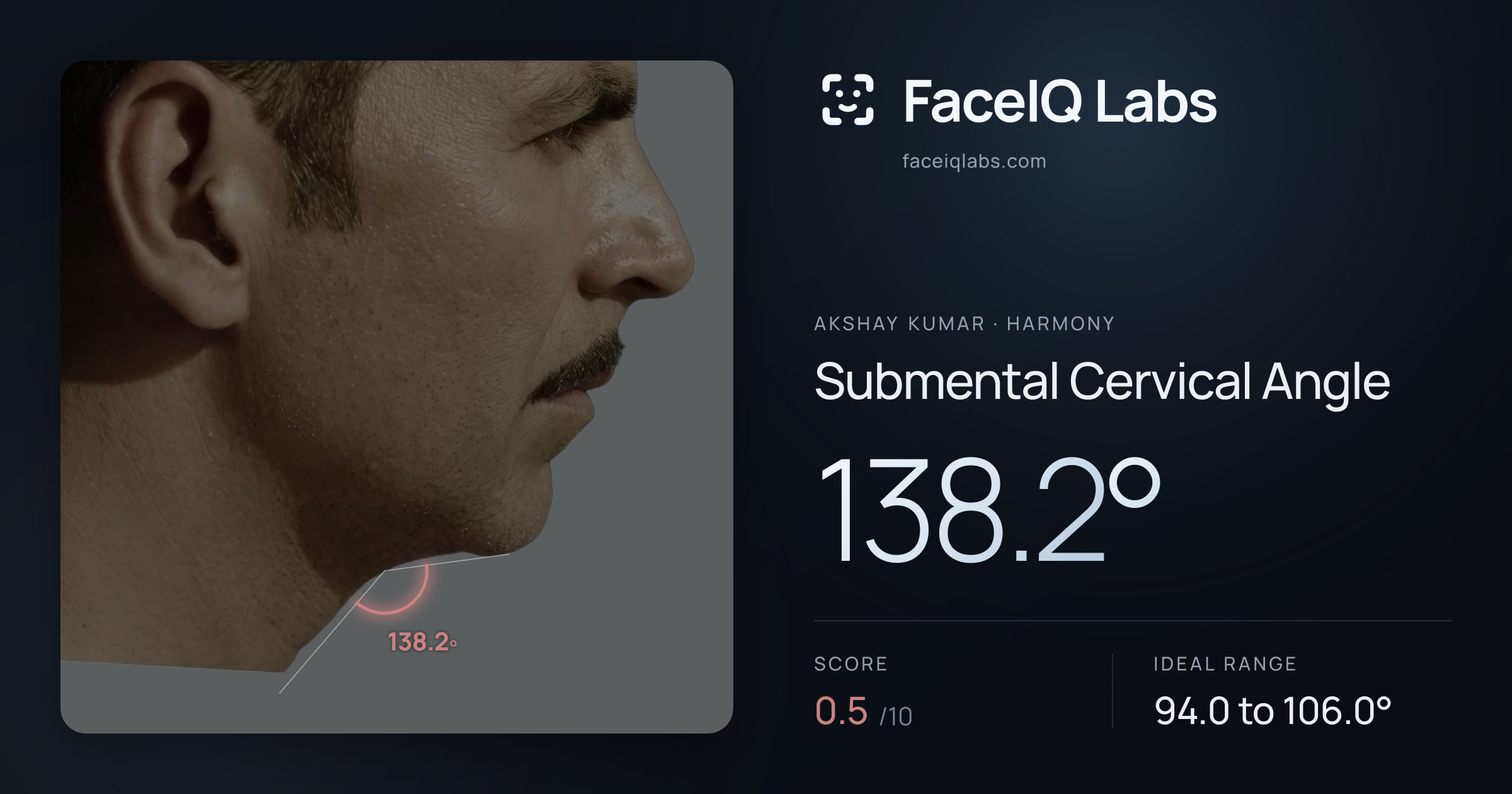 Akshay Kumar Submental Cervical Angle: 138.2°, drawn on the photo