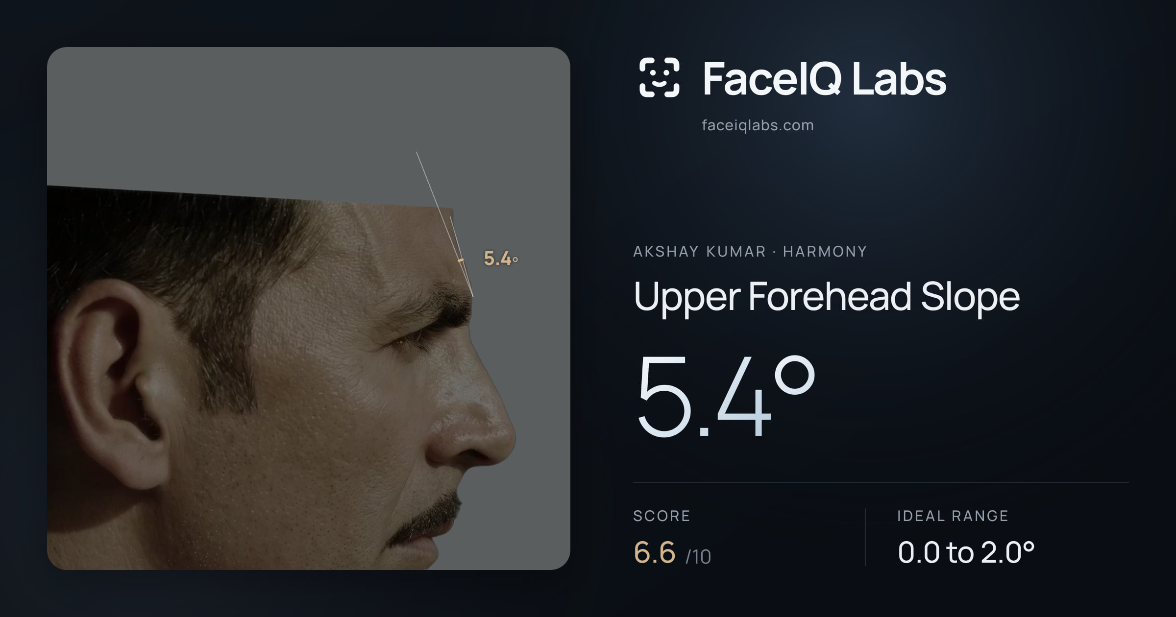Akshay Kumar Upper Forehead Slope: 5.4°, drawn on the photo
