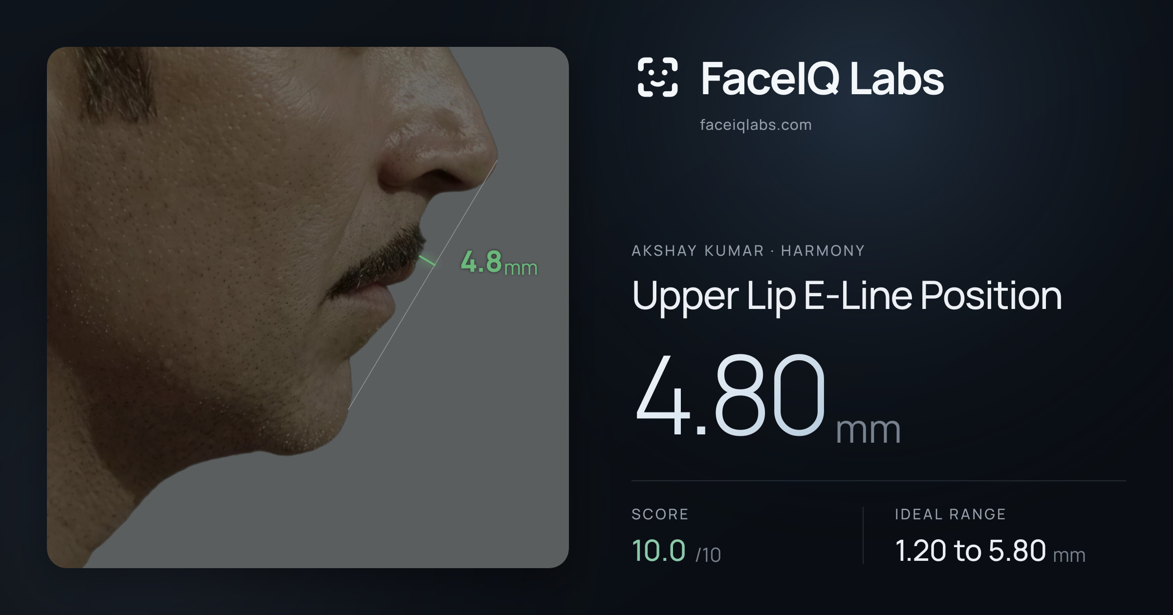 Akshay Kumar Upper Lip E-Line Position: 4.80mm, drawn on the photo