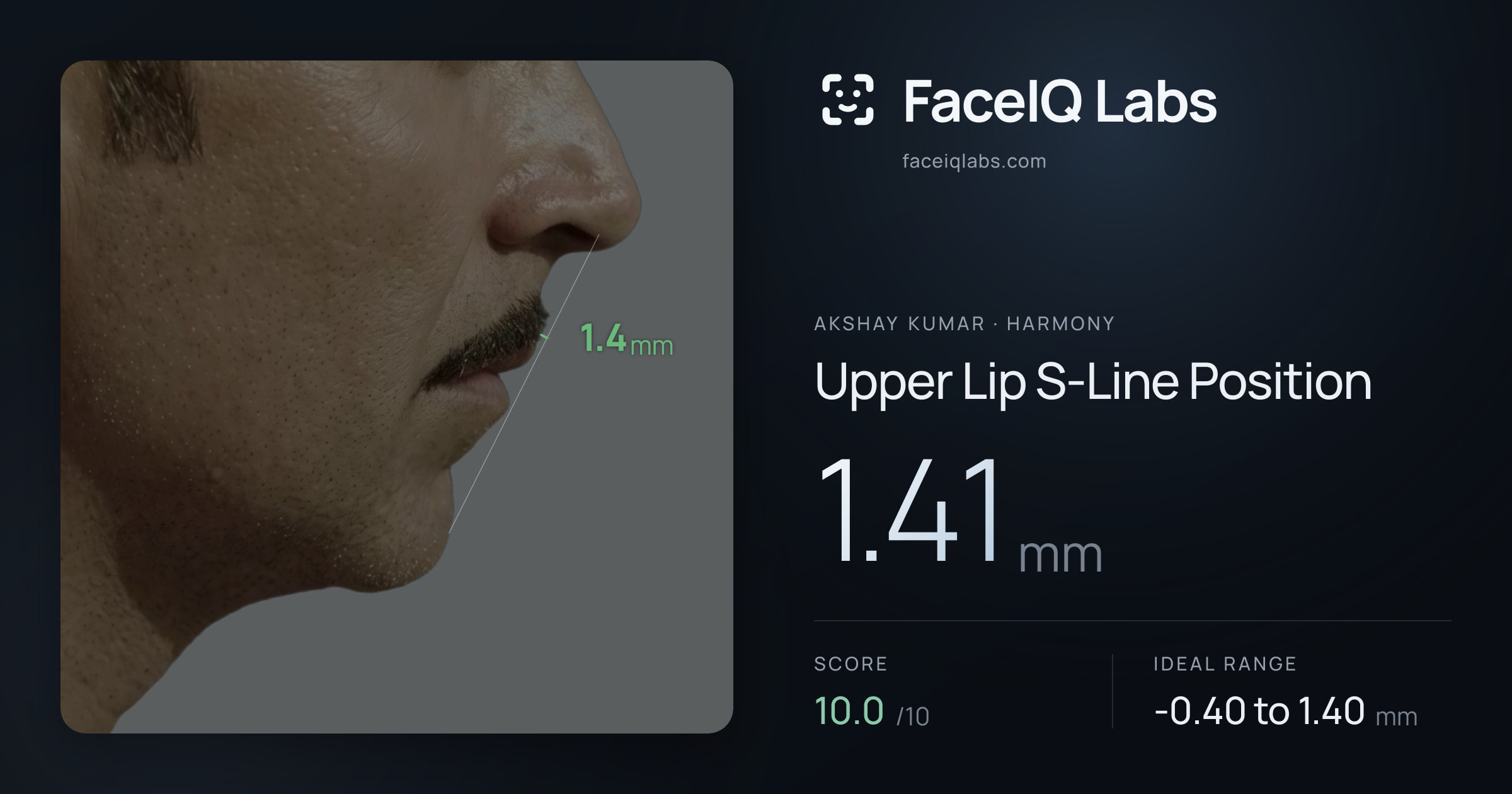 Akshay Kumar Upper Lip S-Line Position: 1.41mm, drawn on the photo