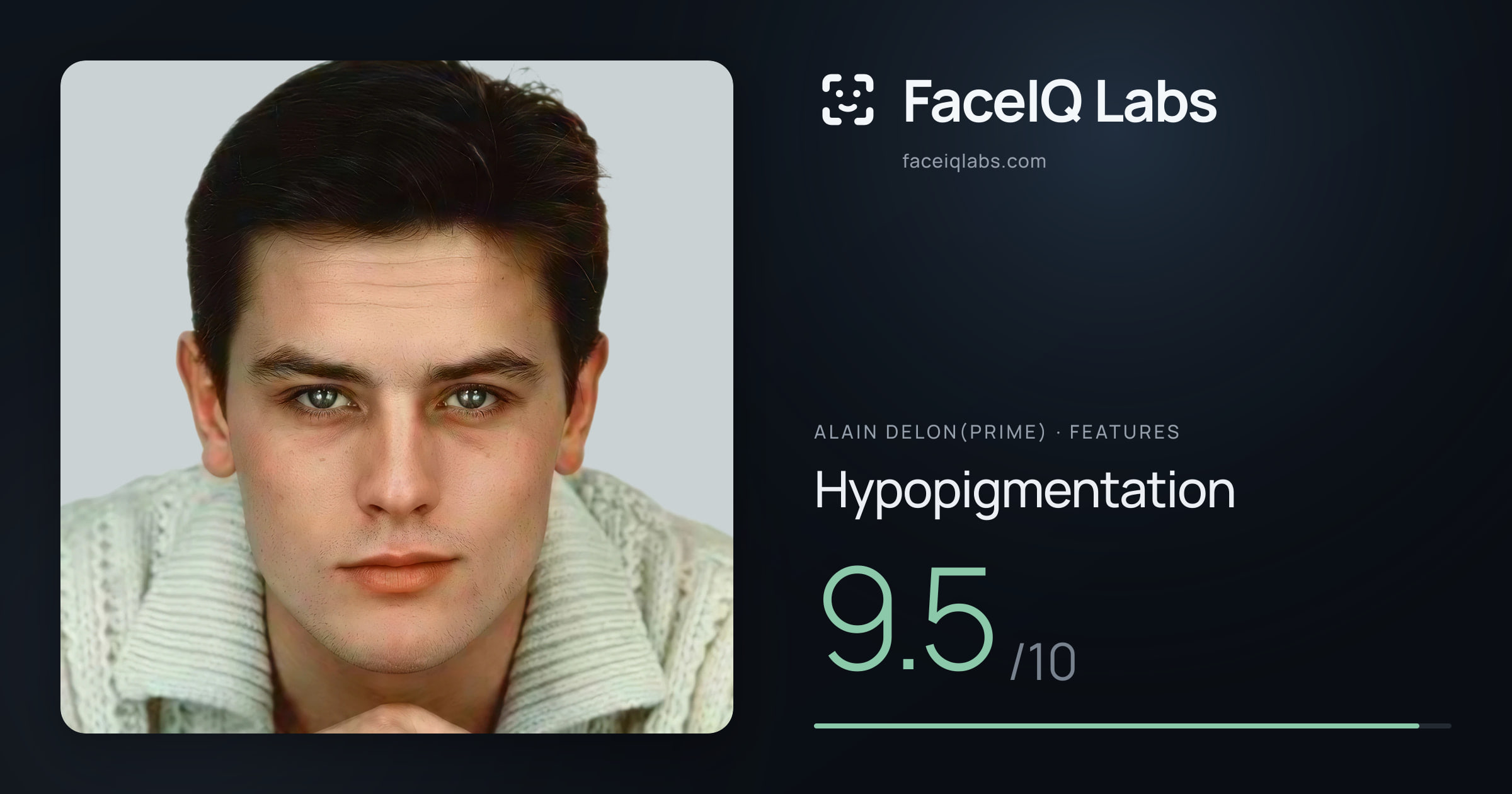 Alain Delon(prime) Hypopigmentation: 9.5/10, drawn on the photo