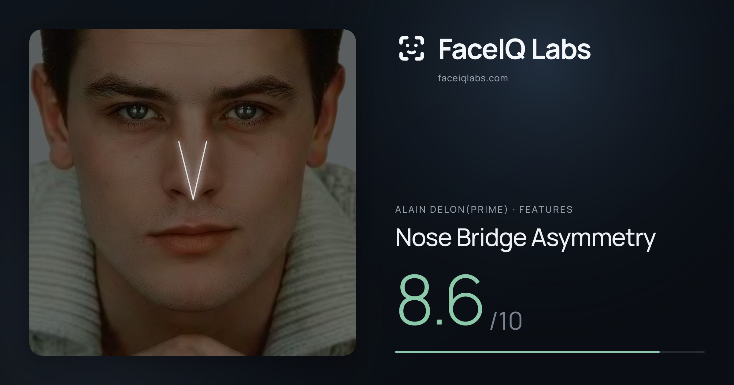 Alain Delon(prime) Nose Bridge Asymmetry: 8.6/10, drawn on the photo