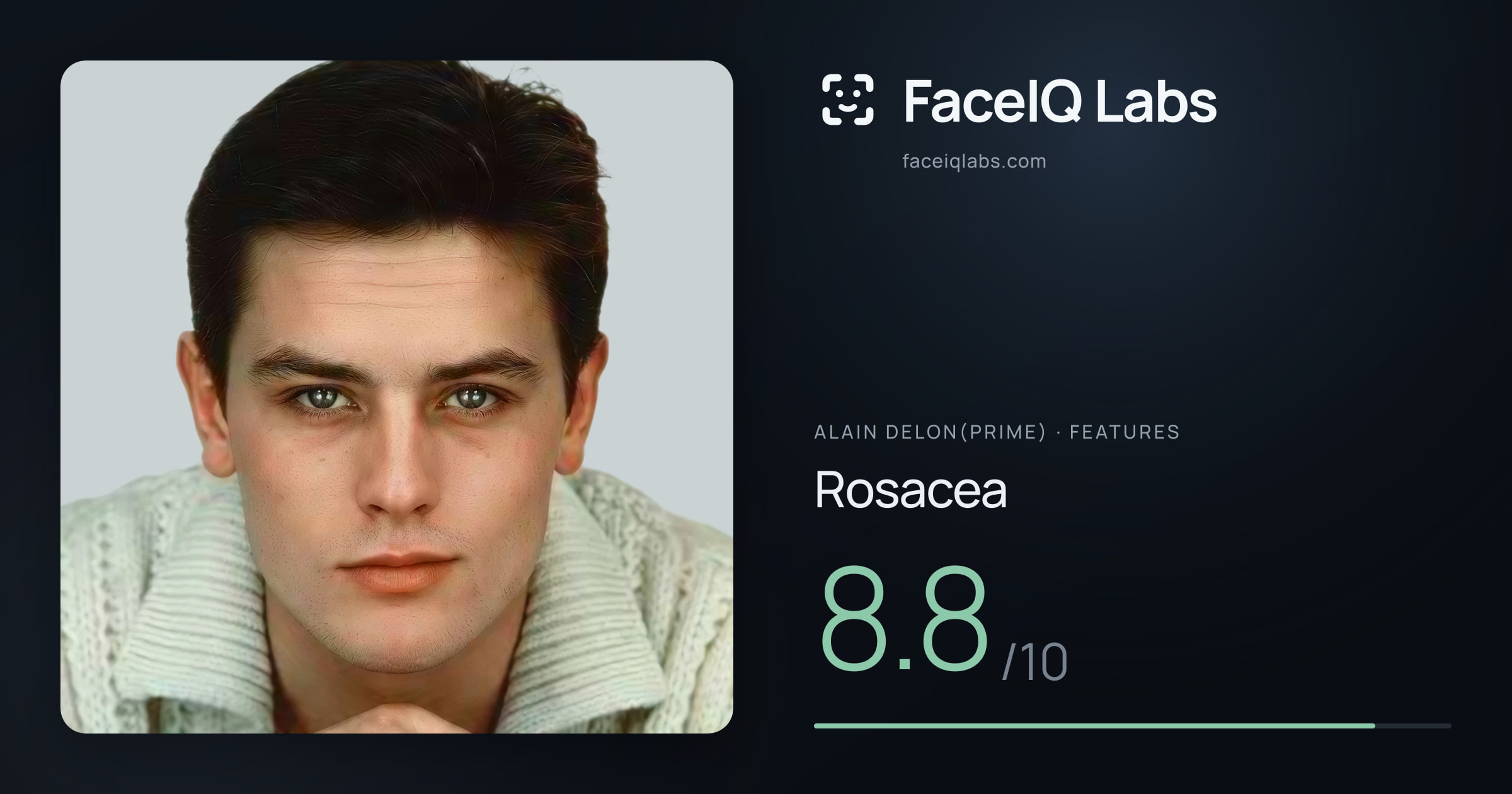 Alain Delon(prime) Rosacea: 8.8/10, drawn on the photo