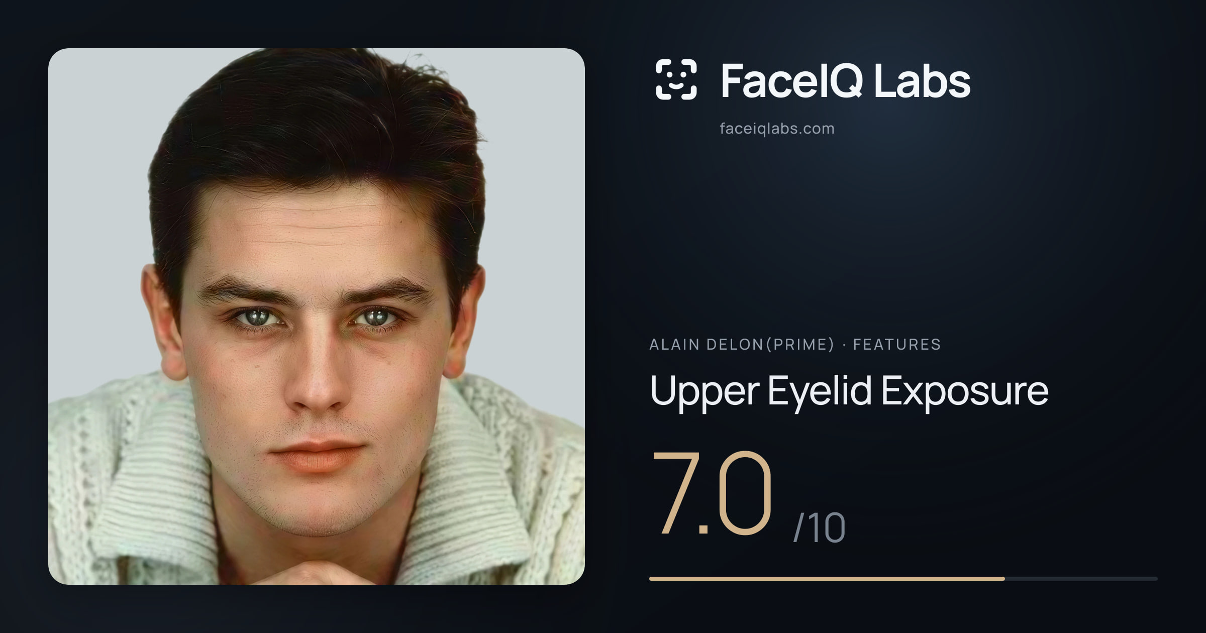 Alain Delon(prime) Upper Eyelid Exposure: 7.0/10, drawn on the photo