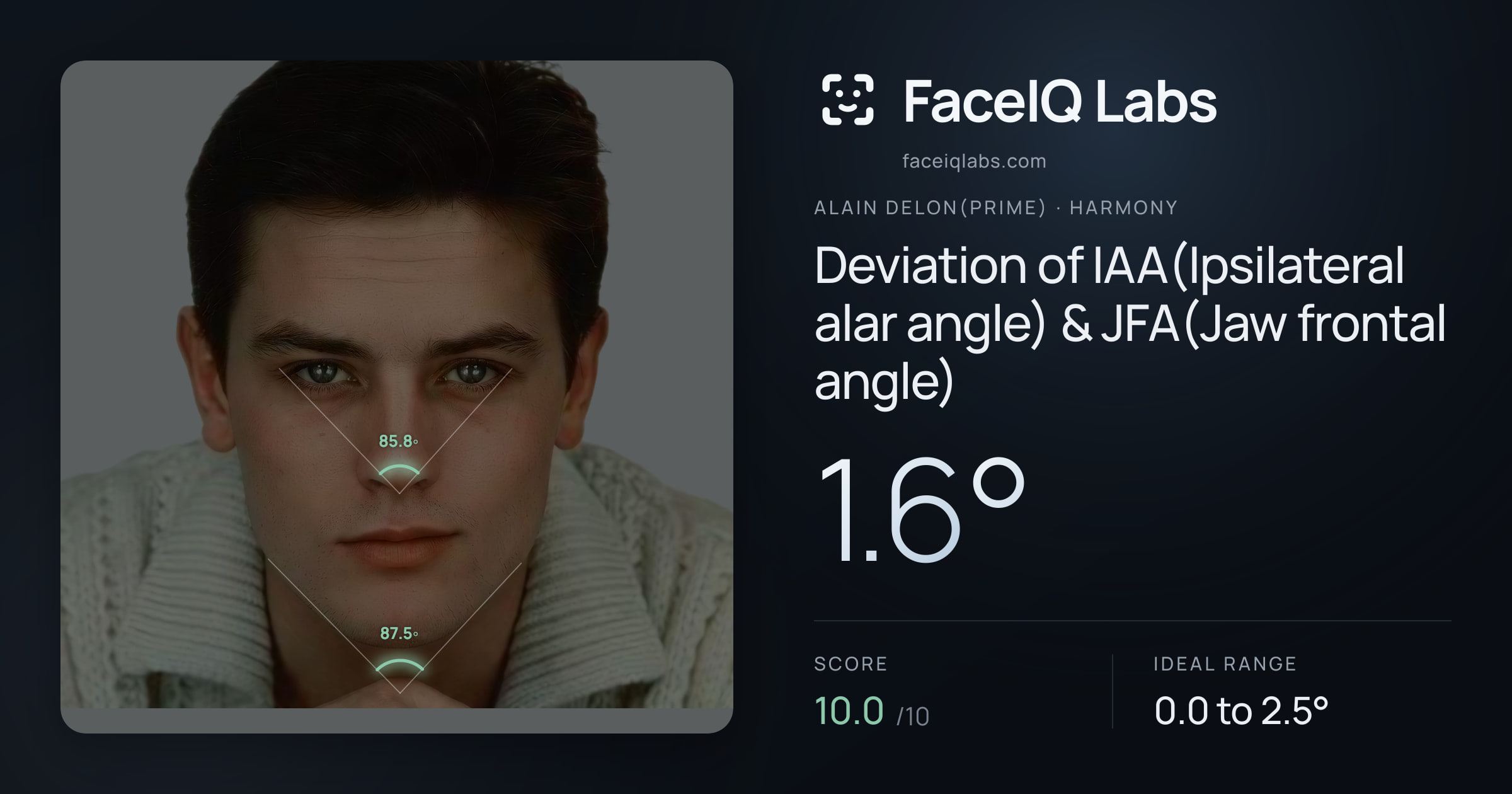 Alain Delon(prime) Deviation of IAA(Ipsilateral alar angle) & JFA(Jaw frontal angle): 1.6°, drawn on the photo